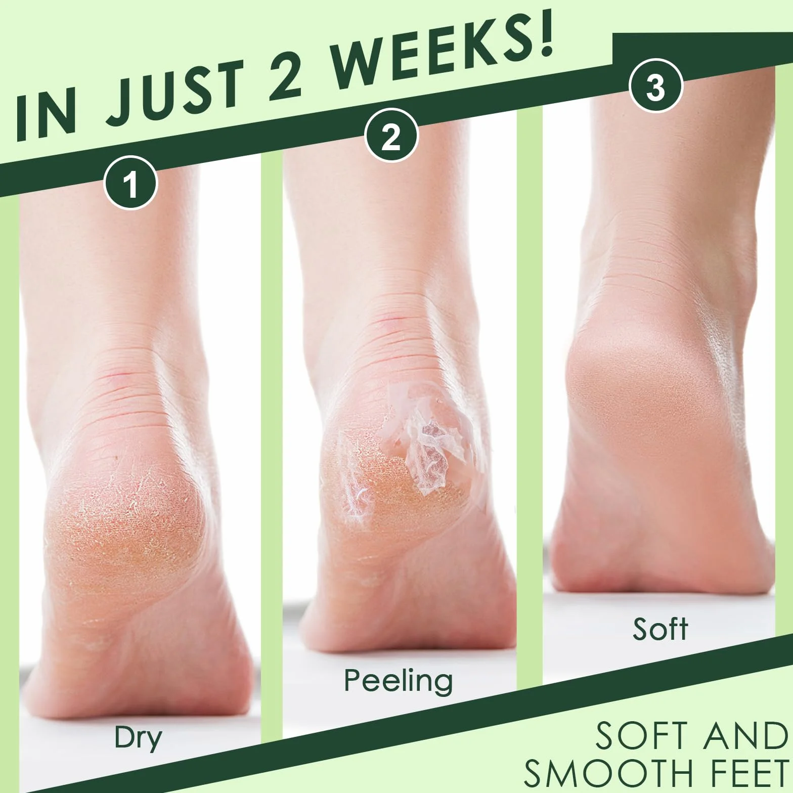 Masque Pieds Peeling Exfoliant Hydratant Peau Lisse Aloès + Avocat 2 Paires