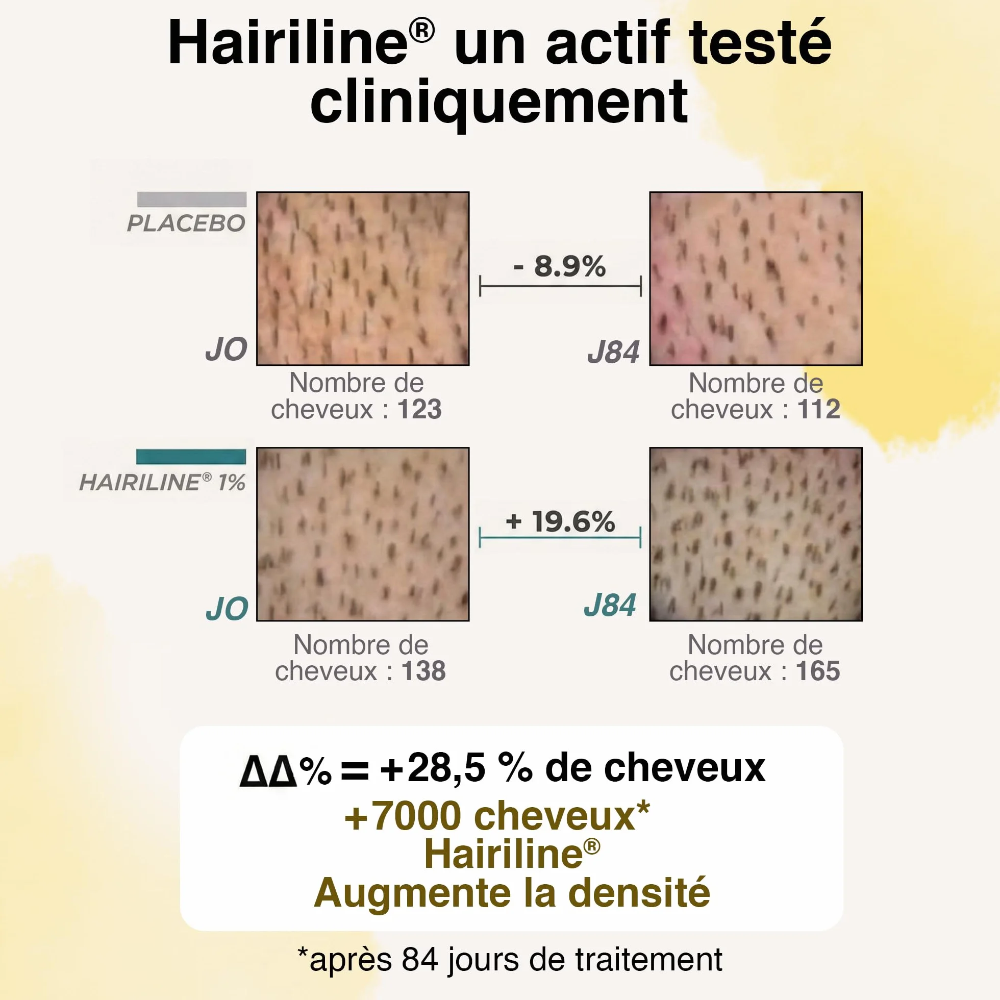 Juste Paris Serum pousse cheveux Bio - Anti chute - Croissance capillaire - Fabriqué en France