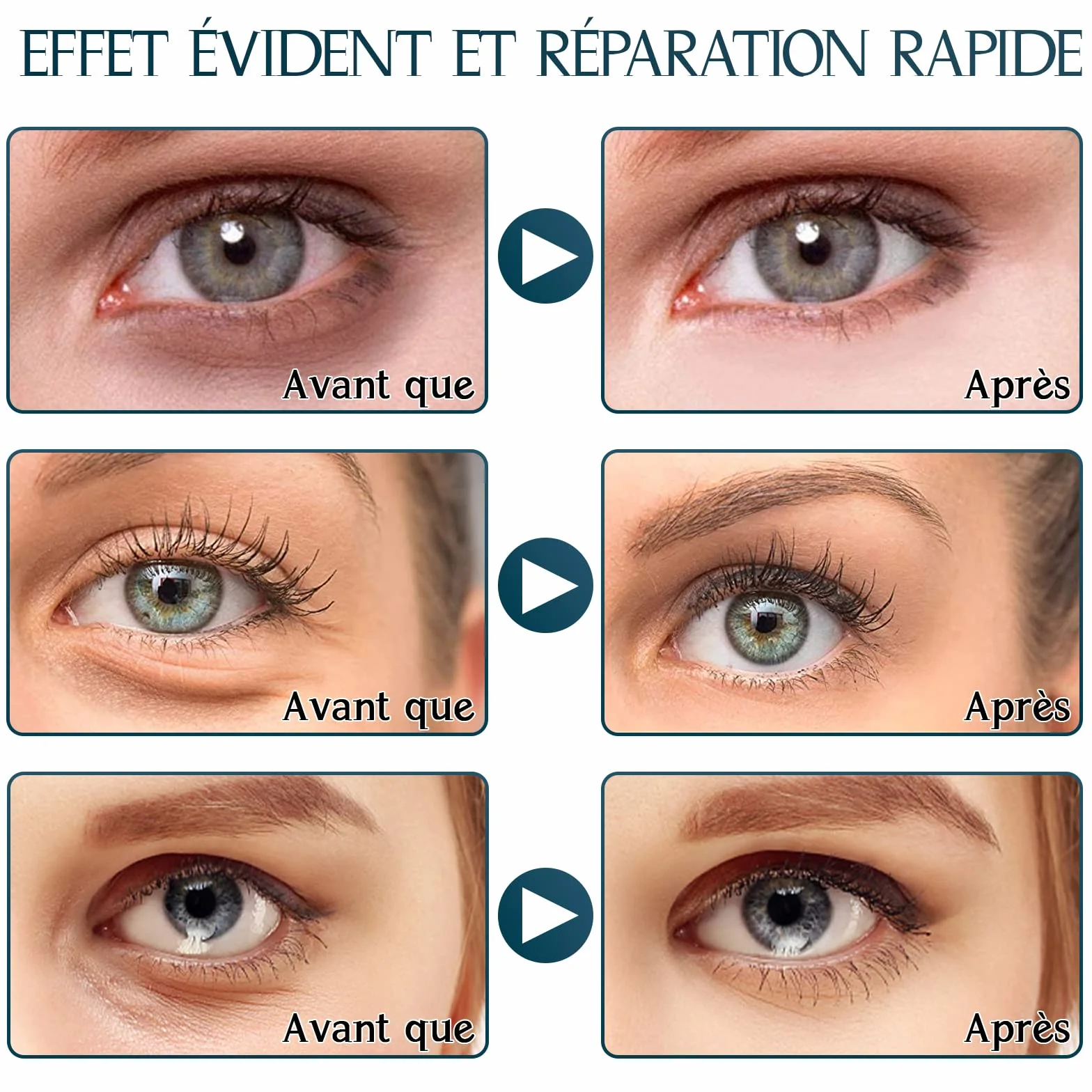 Masque Yeux Collagène 30 Paires Anti-âge Cernes Poches Rides Hydratant