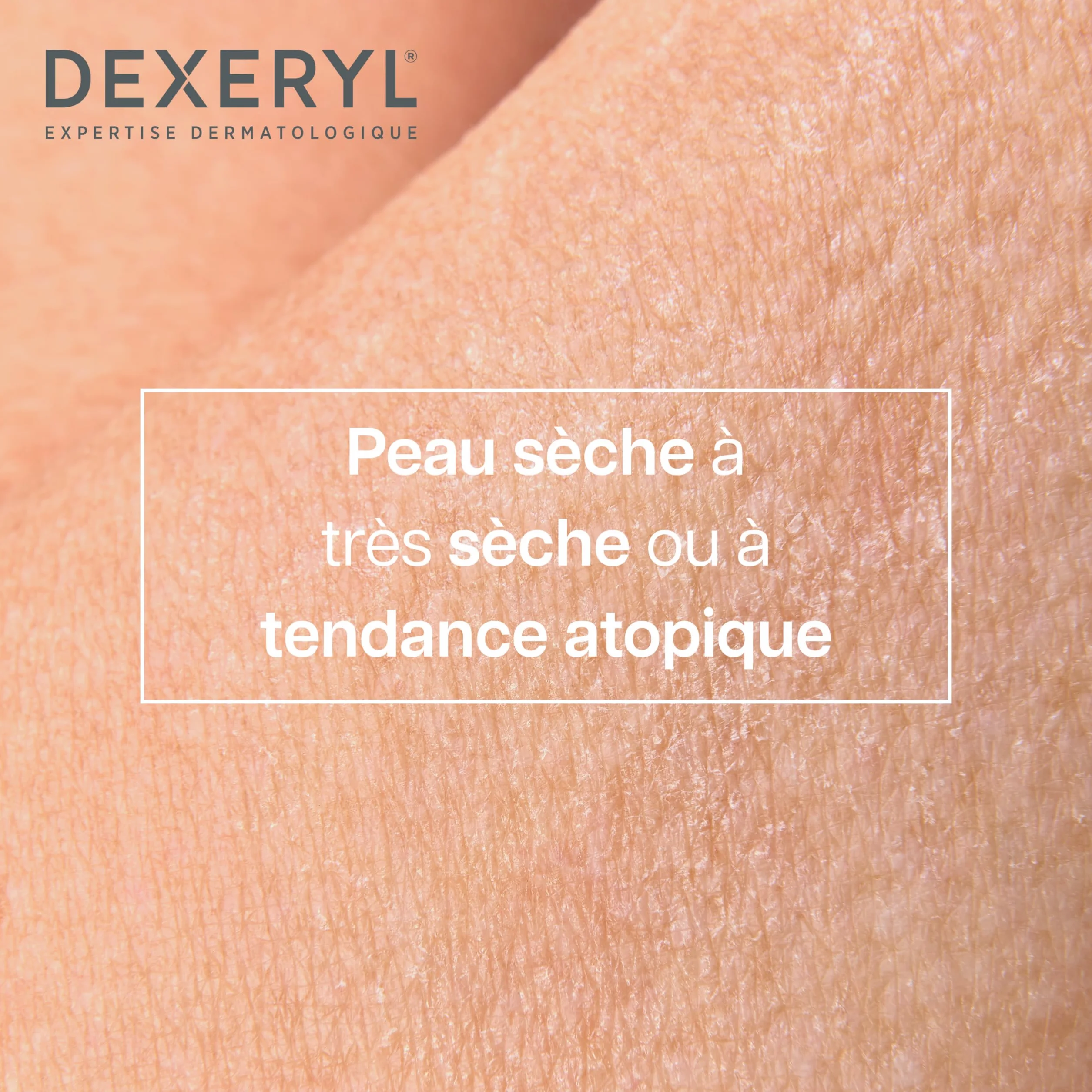 DEXERYL Huile de Douche Apaisante 1L Peaux Très Sèches Atopique Sans Savon Sans Parfum