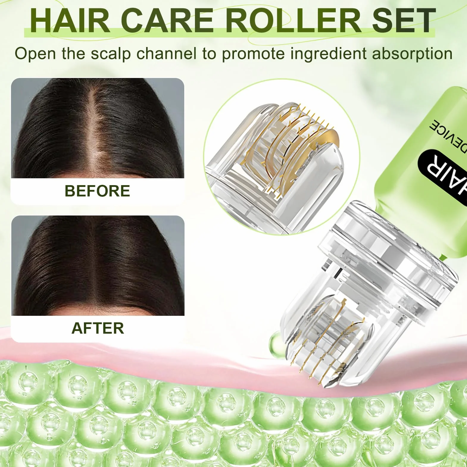 AlphaInfuse Système de croissance cheveux micro-infusion sans douleur repousse rapide