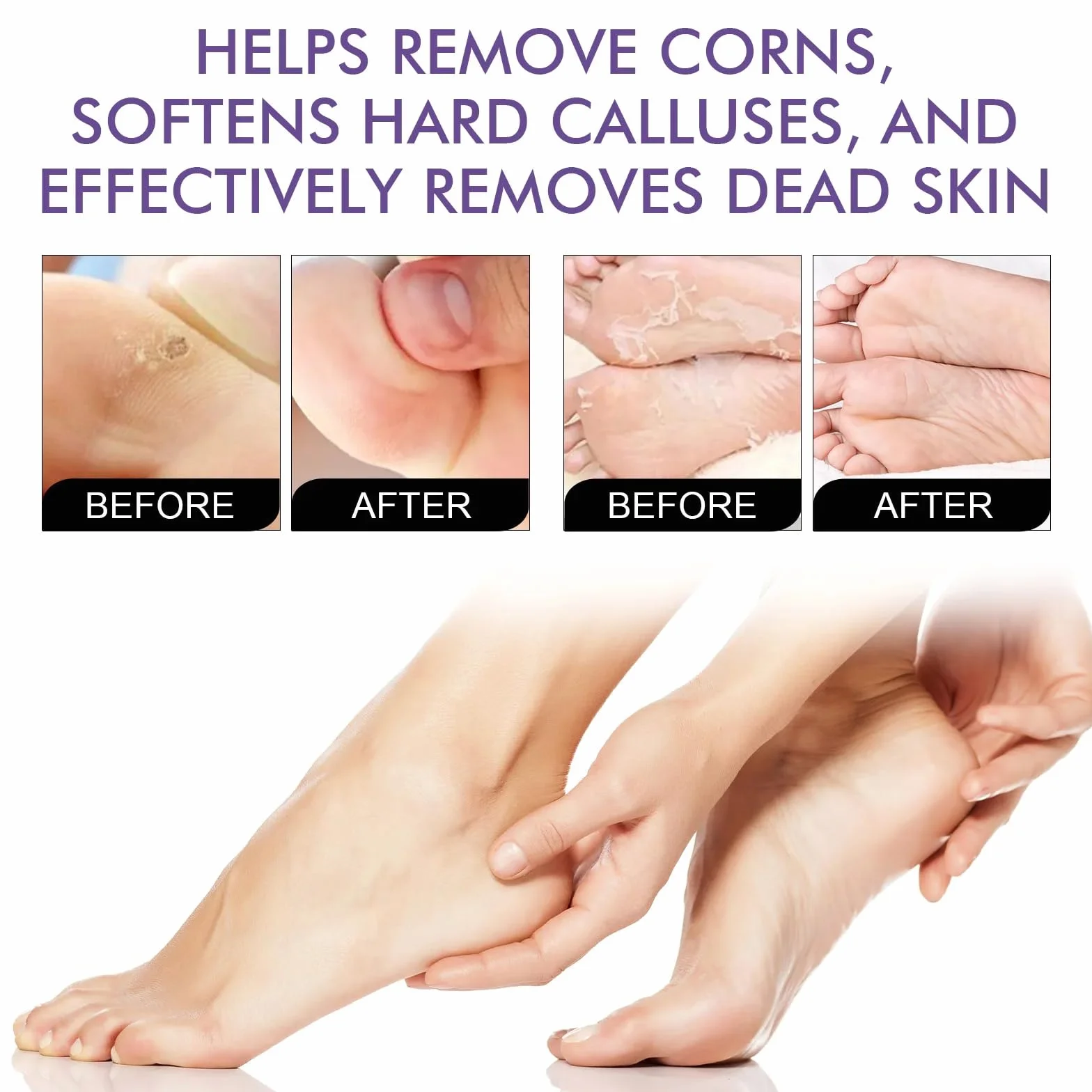 Masque Pied Peeling 5 Paires | Chaussette Exfoliante Pieds Secs Abîmés | Gommage Callus Soin Peau Morte