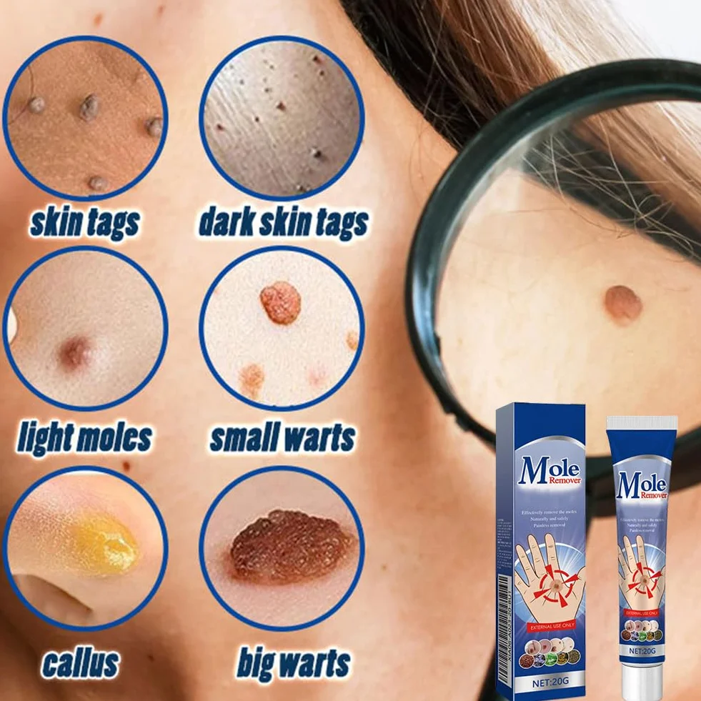 Crème Anti-Verrues et Anti-étiquettes Cutanées 20g