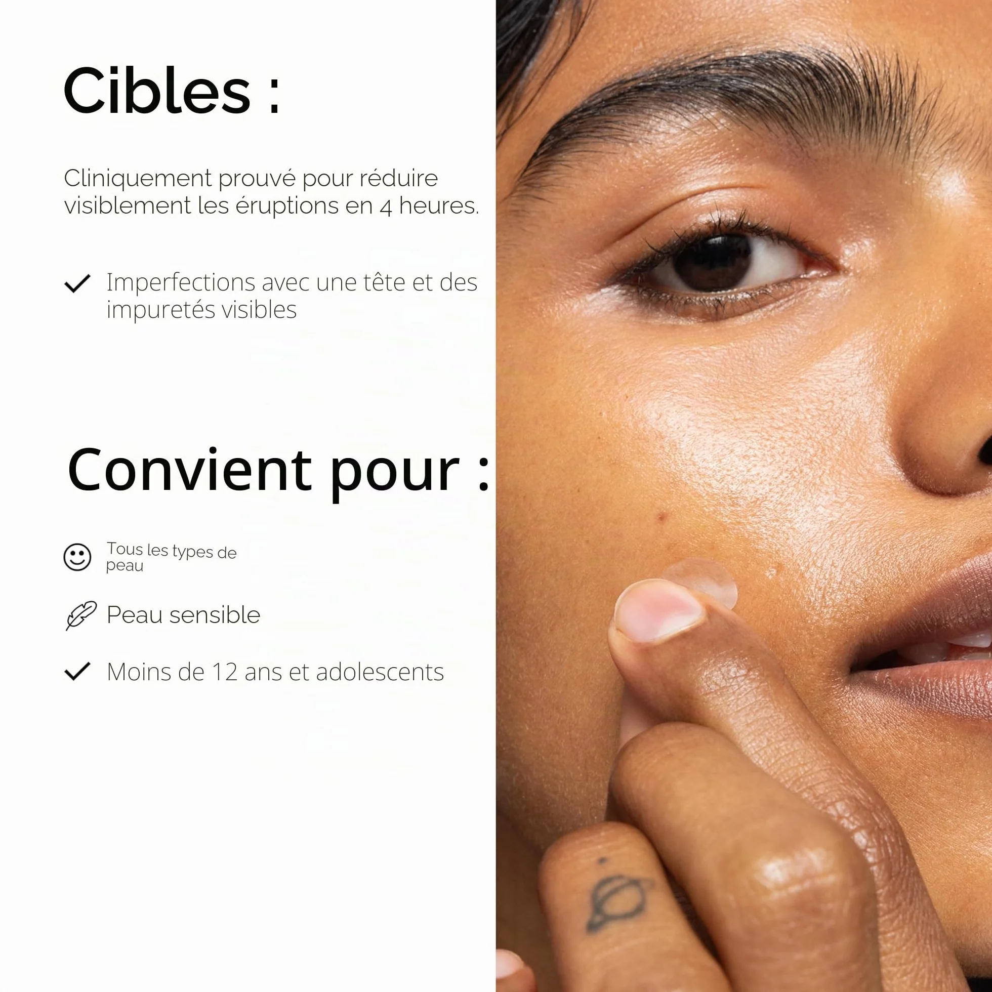 The INKEY list Patchs Hydrocolloïdes Invisibles Anti-Acné Jour/Nuit avec Acide Salicylique