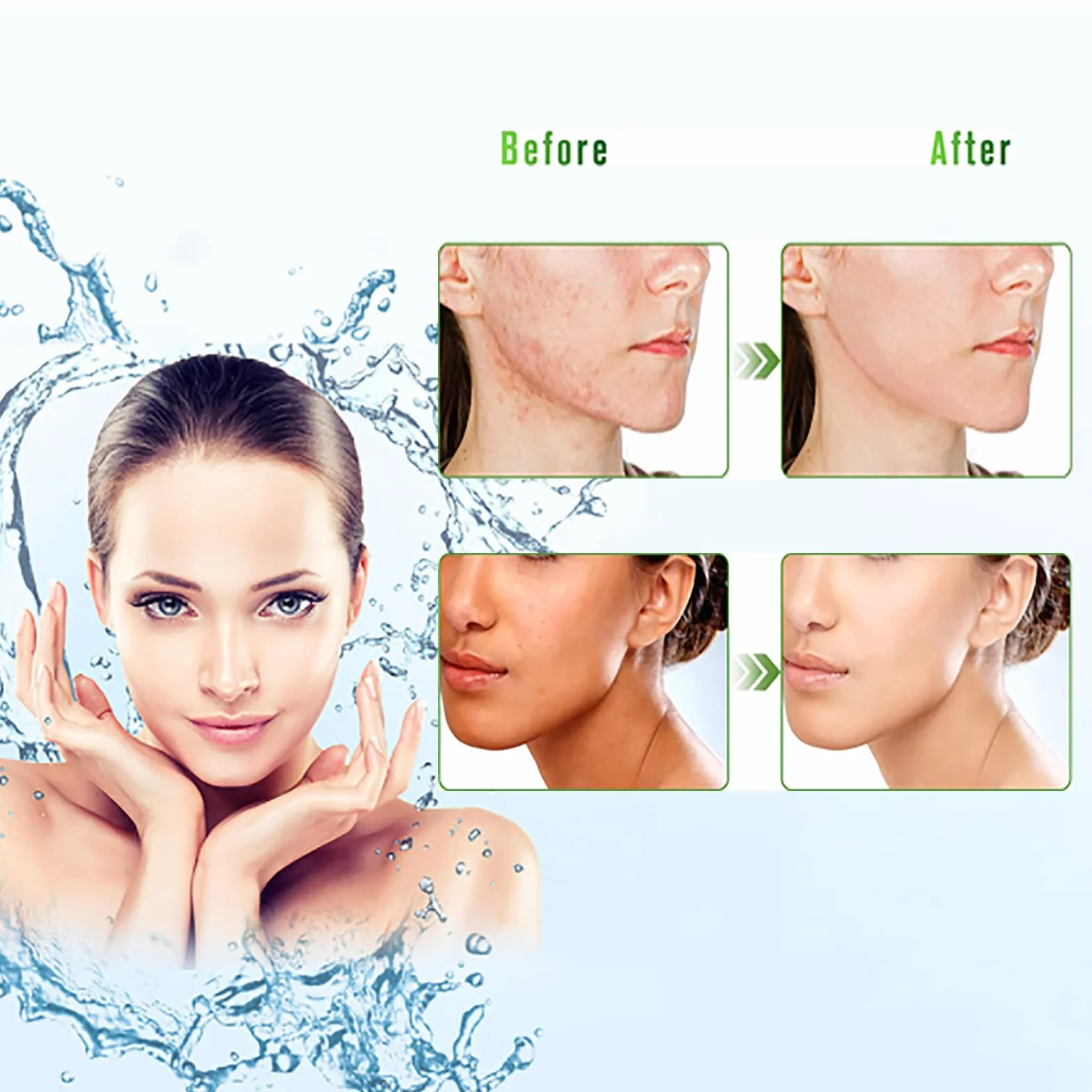 Aloe Vera Gel 300 ml 99% Hydratant Visage et Corps Peaux Sèches Crème Naturelle