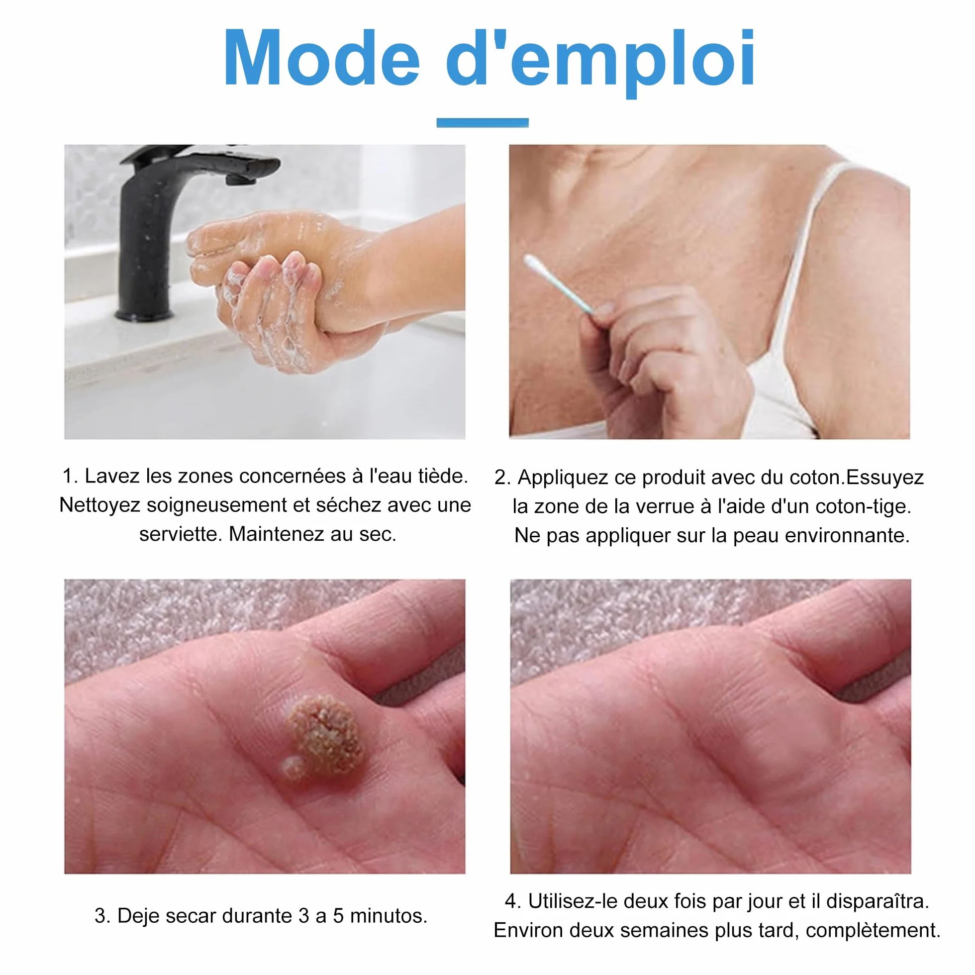 Crème Anti Verrue 20g Élimination Verrues Plantaires Vulgaris Cors Planes
