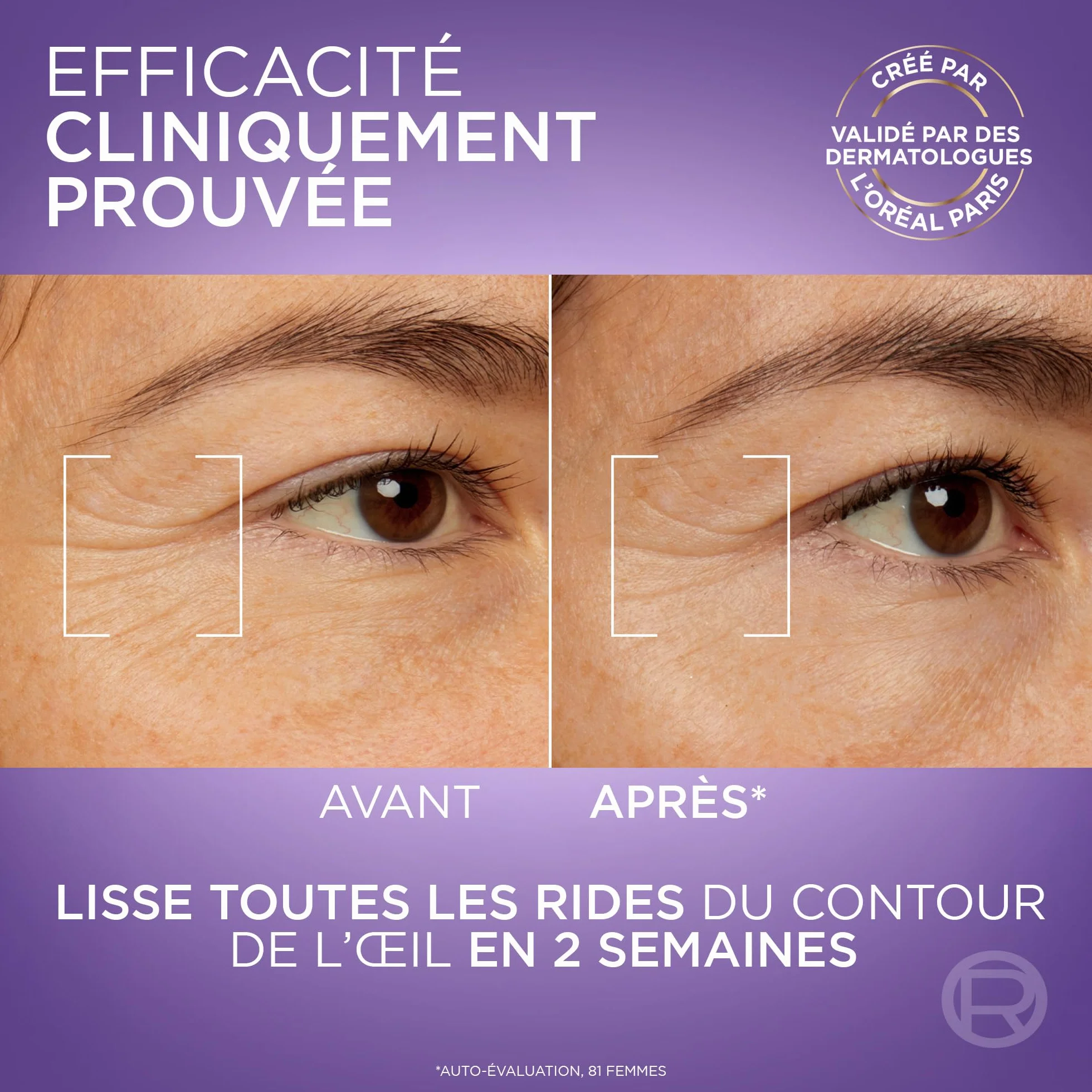 L'Oréal Paris Revitalift Filler Sérum Contour des Yeux Anti-Rides 20 ml