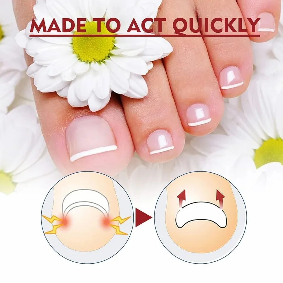 German Toenailplus Anti Paronychia Relief Oil, Paronychia Treatment for Toe and Fingernail Repair (2pcs)