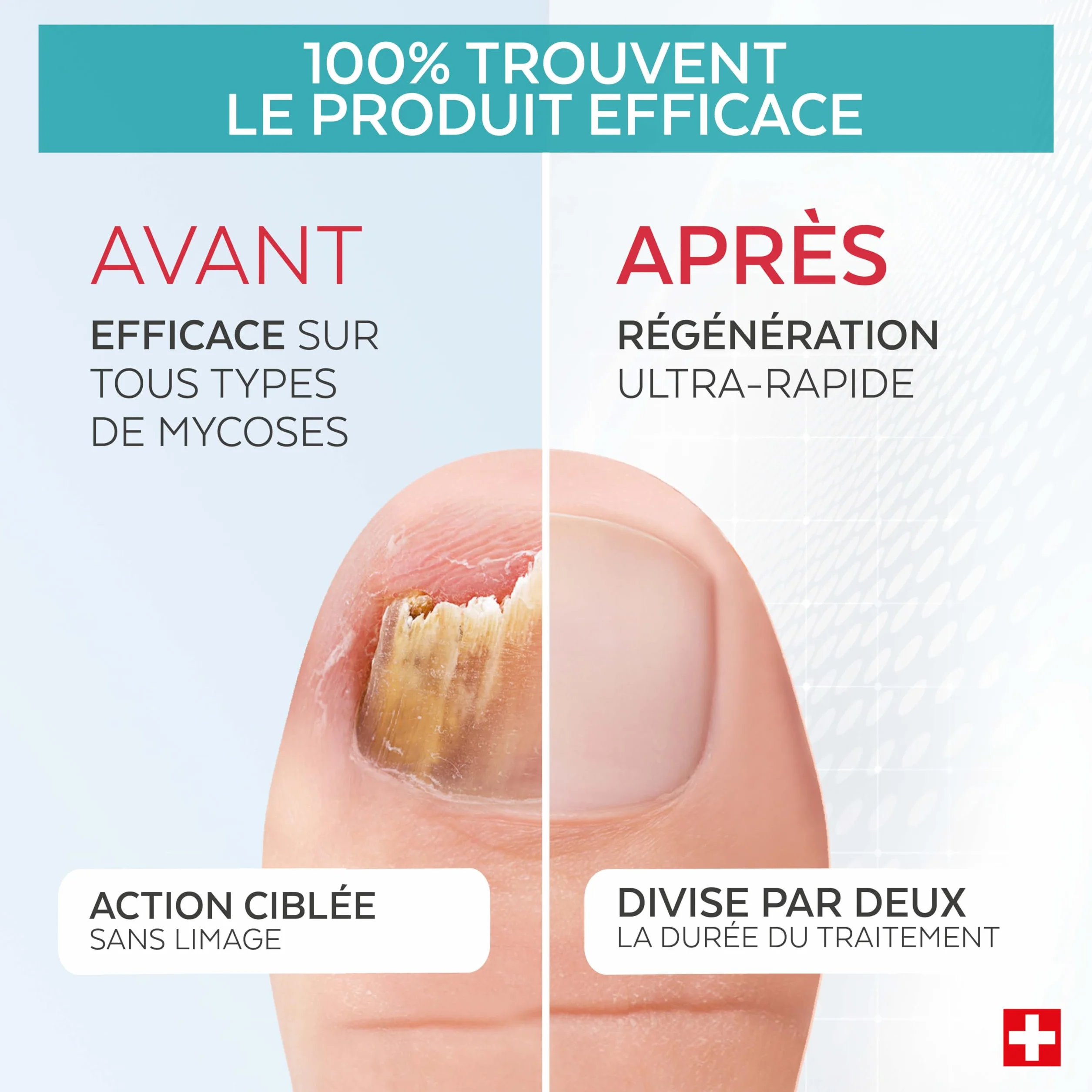 PODERM 2en1 Traitement Mycose Ongles des Pieds Pack Duo Sérum Booster Soin Puissant Rapide Ongles Jaunes Cassants Abîmés 100% Naturel Podologue Suisse