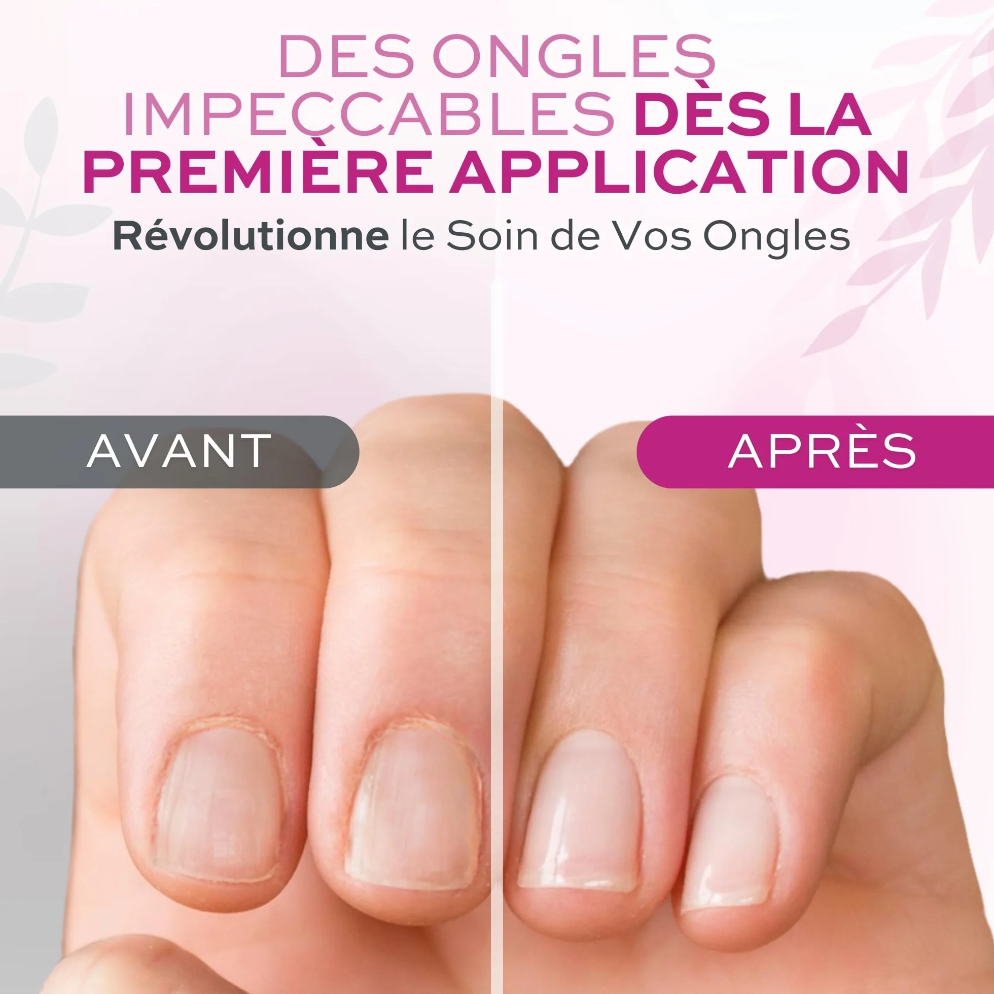 Vernis Cuticules Remover 12 ml - Dissout et enlève le traitement des cuticules pour les ongles