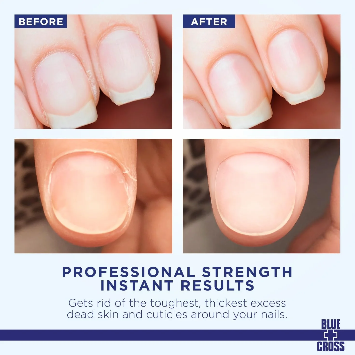 Blue Cross Cuticle Remover 6 Oz