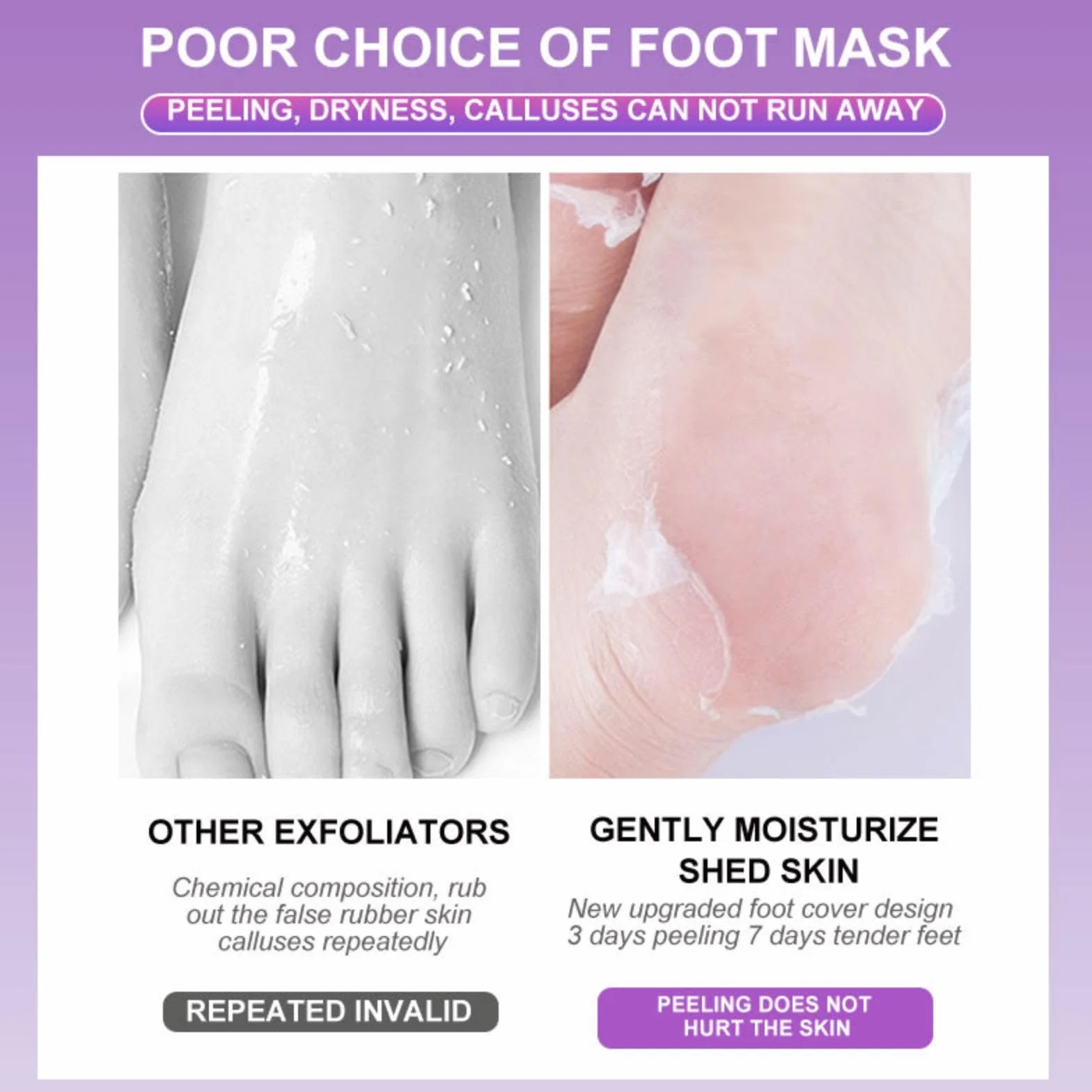 Joyeee Masque Peeling Pieds Exfoliant Nourrissant Chaussettes Soin Pieds Lavande