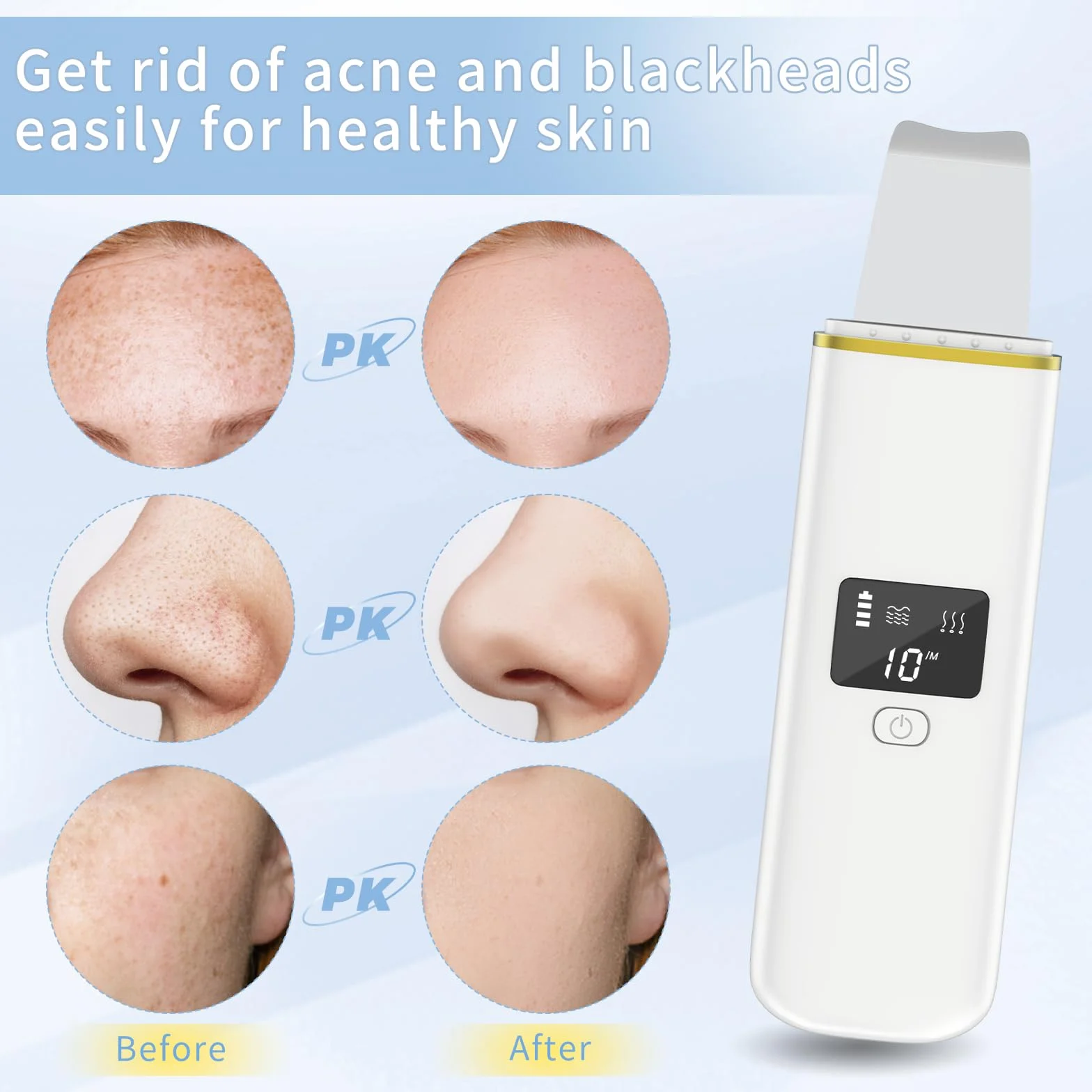 CARER SPARK Épurateur de Peau, Epurateur Ultrasonique Visage avec 4 modes, Spatule pour la peau Vibration Peeling Appareil de Nettoyage Pore et Point Noirs