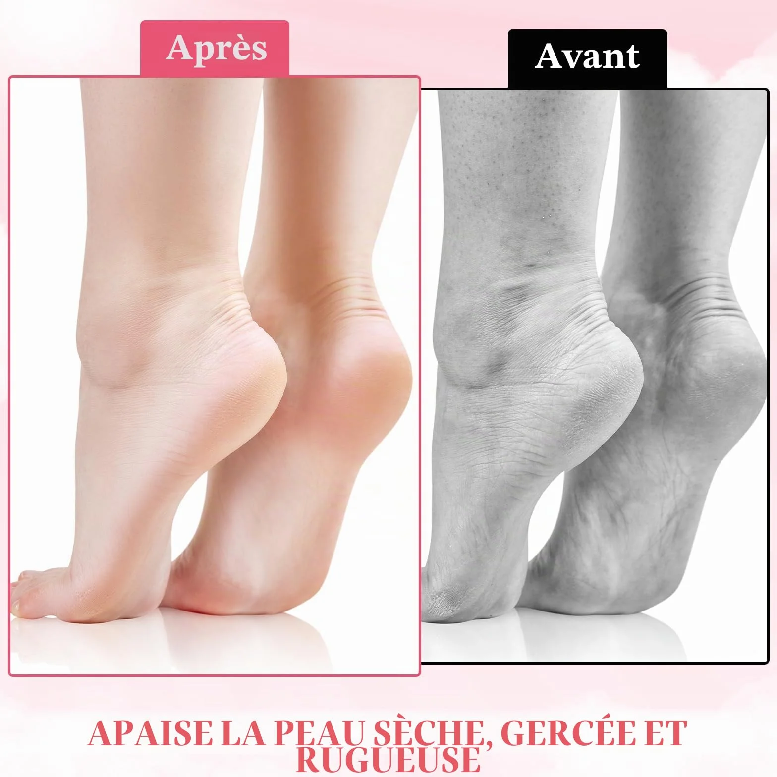 Chaussettes en silicone hydratantes pour femme, gel doux à l'aloès, chaussettes de pédicure spa