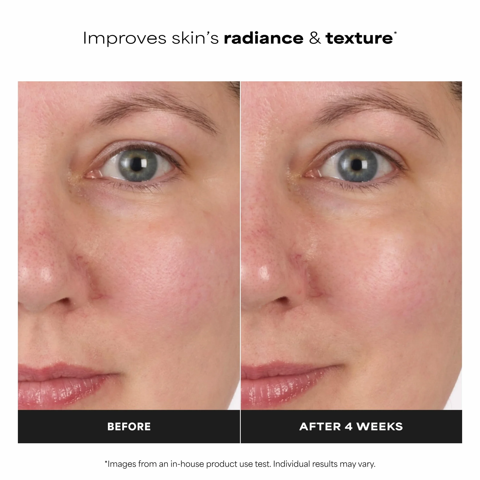 Paula's Choice SKIN BALANCING Lotion Tonique Visage - Vitamin B3 Tonique - Réduire Les Points Noirs, Imperfections & Pores Dilatés - avec Niacinamide - Peaux Mixtes à Grasses - 190 ml