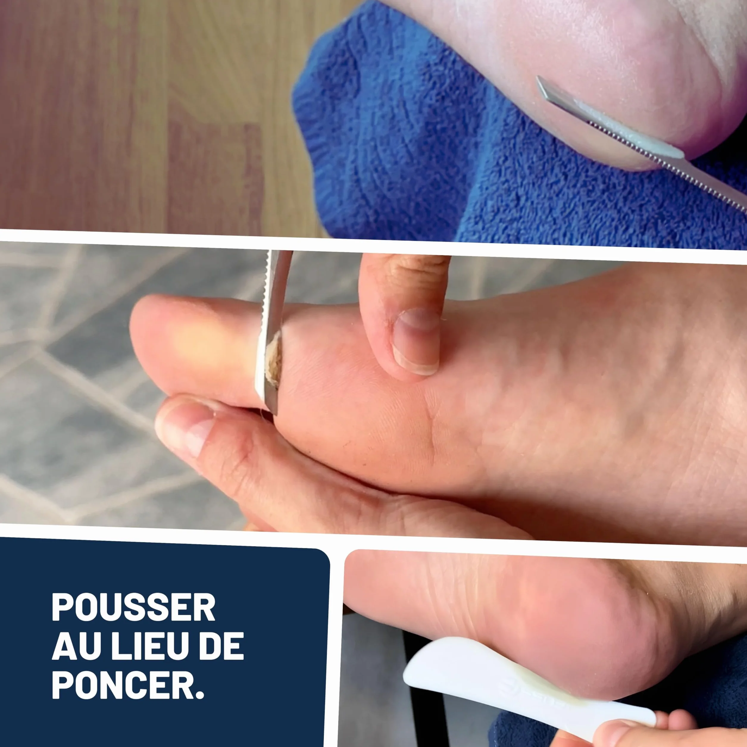 Mr. Fuss Solution No. 4 pour enlever la callosité 250ml Plus Pack Multi adoucissement rapide