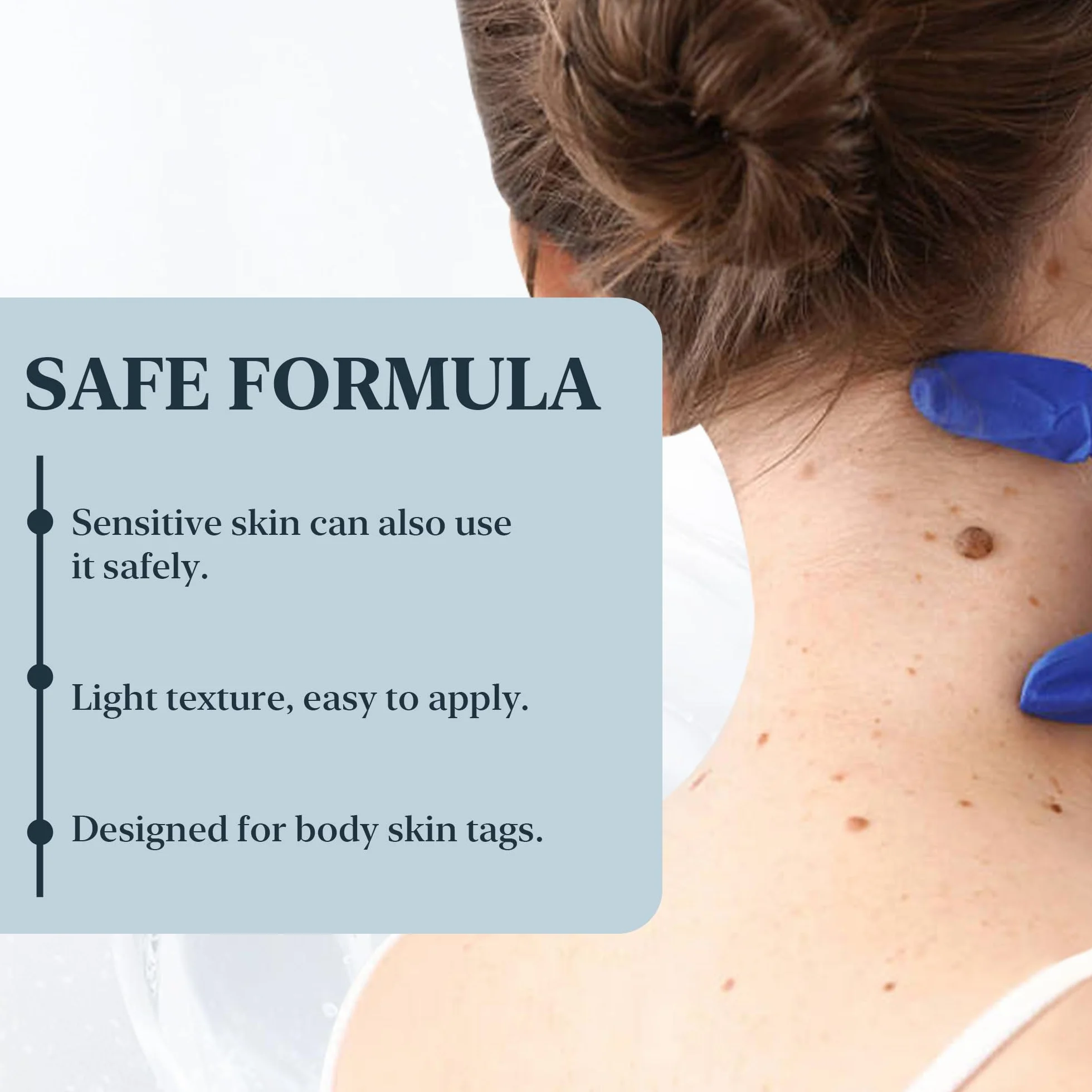 Anti Verrue Plantaire 10 ml | élimination Des Acrochordons | Soin Localisé pour Pieds et Mains