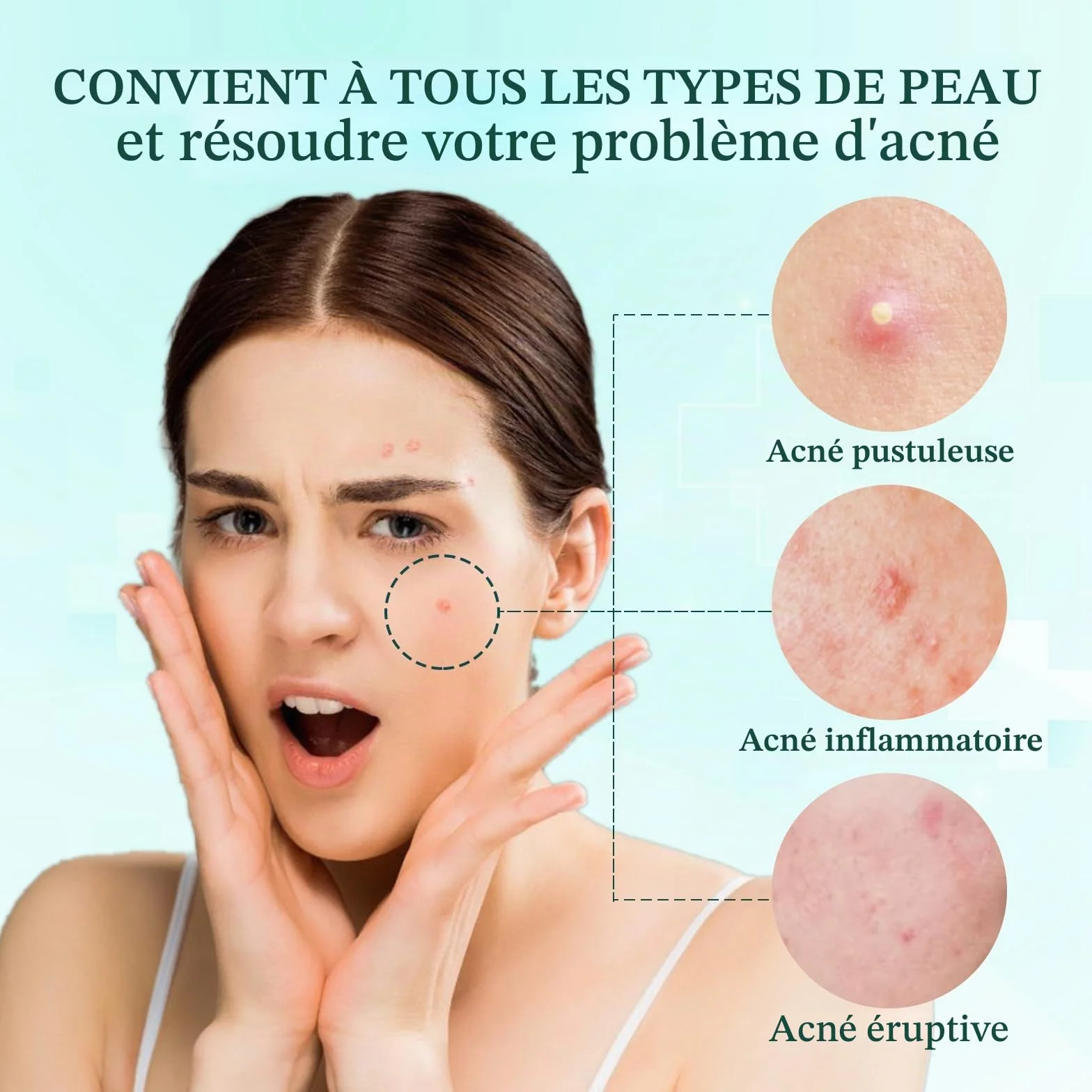 Patch Bouton Etoile Hydrocolloïde 408 PCS, Anti Acné Invisible avec Huile Tea Tree et Acide Salicylique