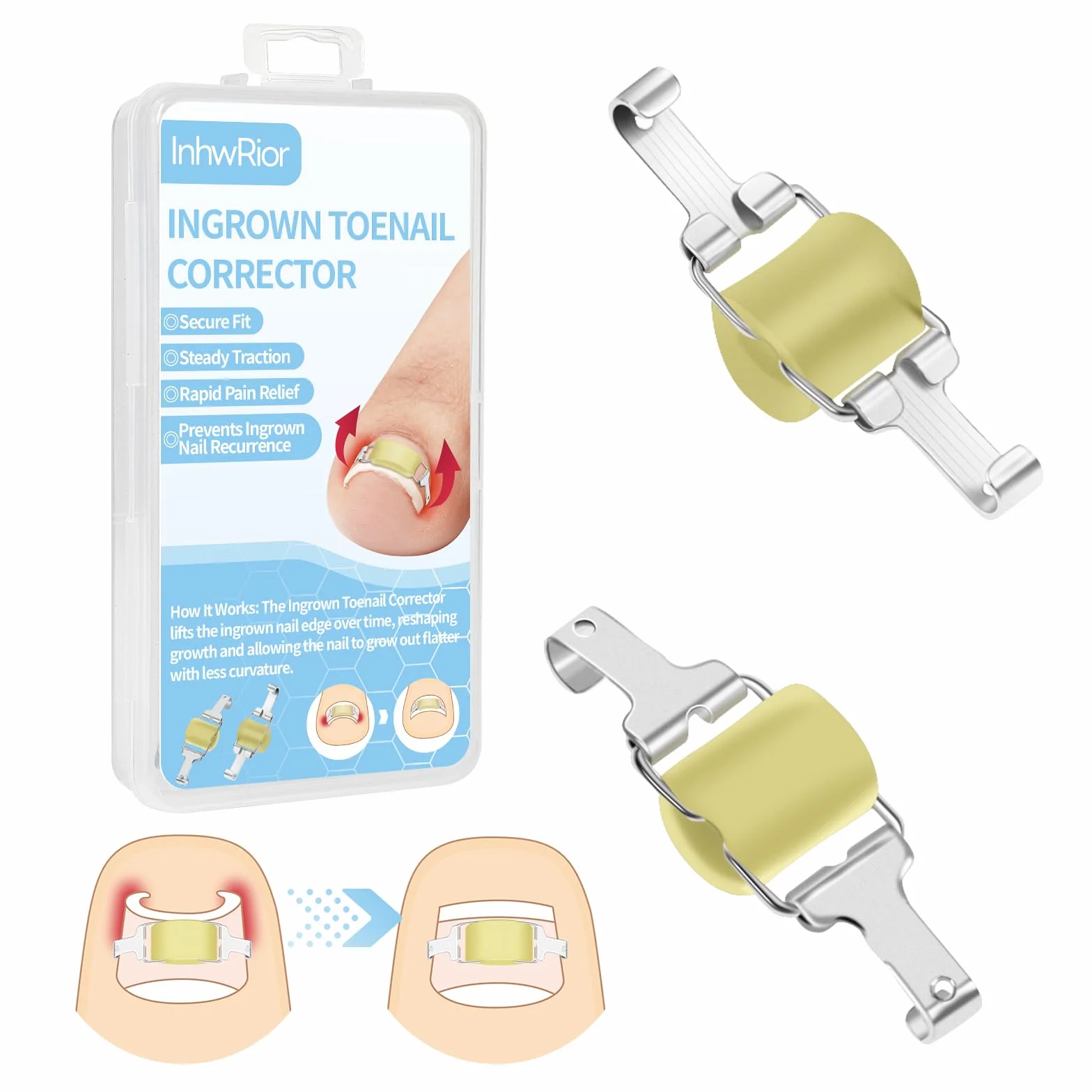 InhwRior Correcteur d’ongle incarné,facile à utiliser à la maison, stable et sûr, sans glissement, traction continue pour un soulagement rapide de la douleur, étanche pour la douche(19mm-21mm)
