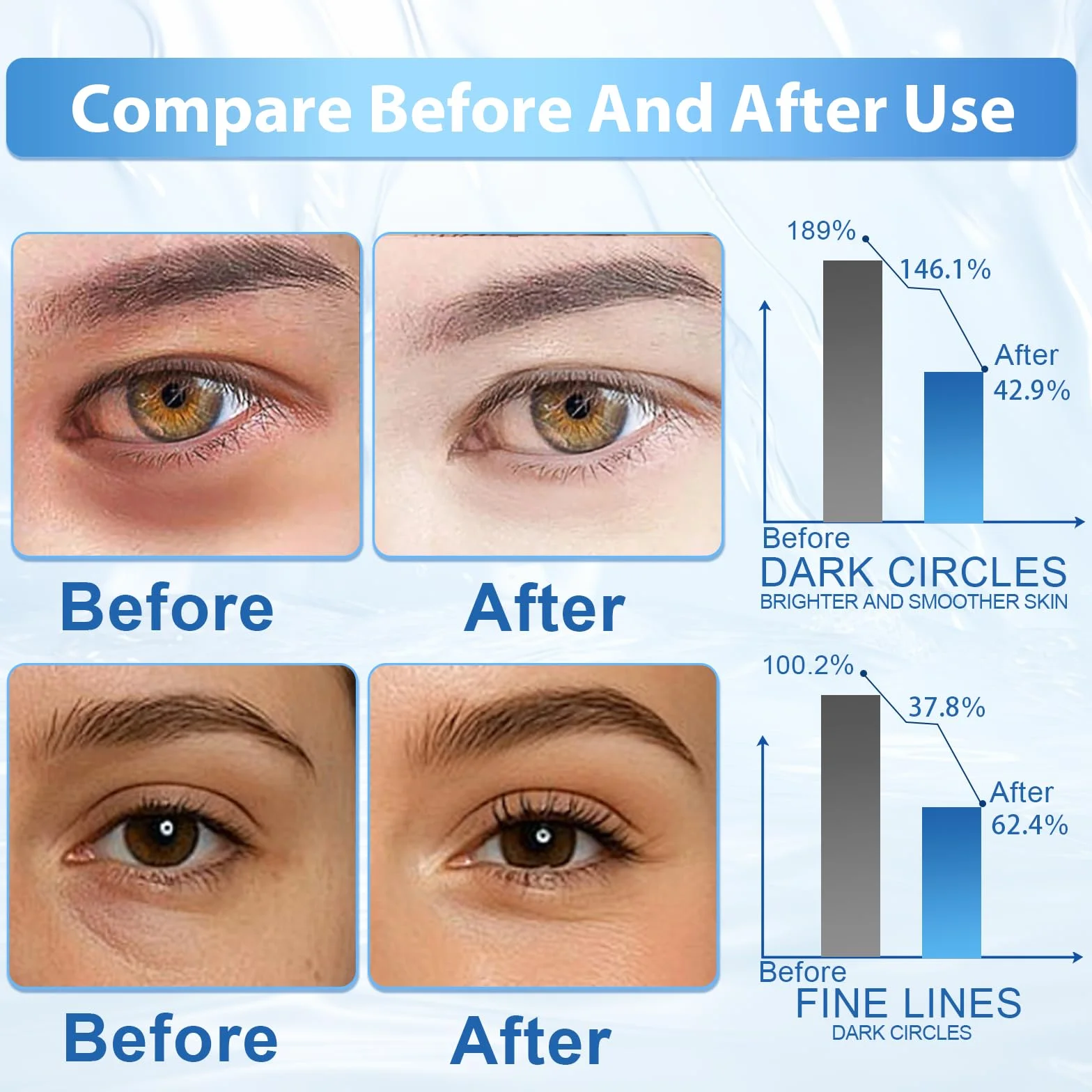 Patch Yeux caféine acide hyaluronique anti cernes poches rides masque yeux