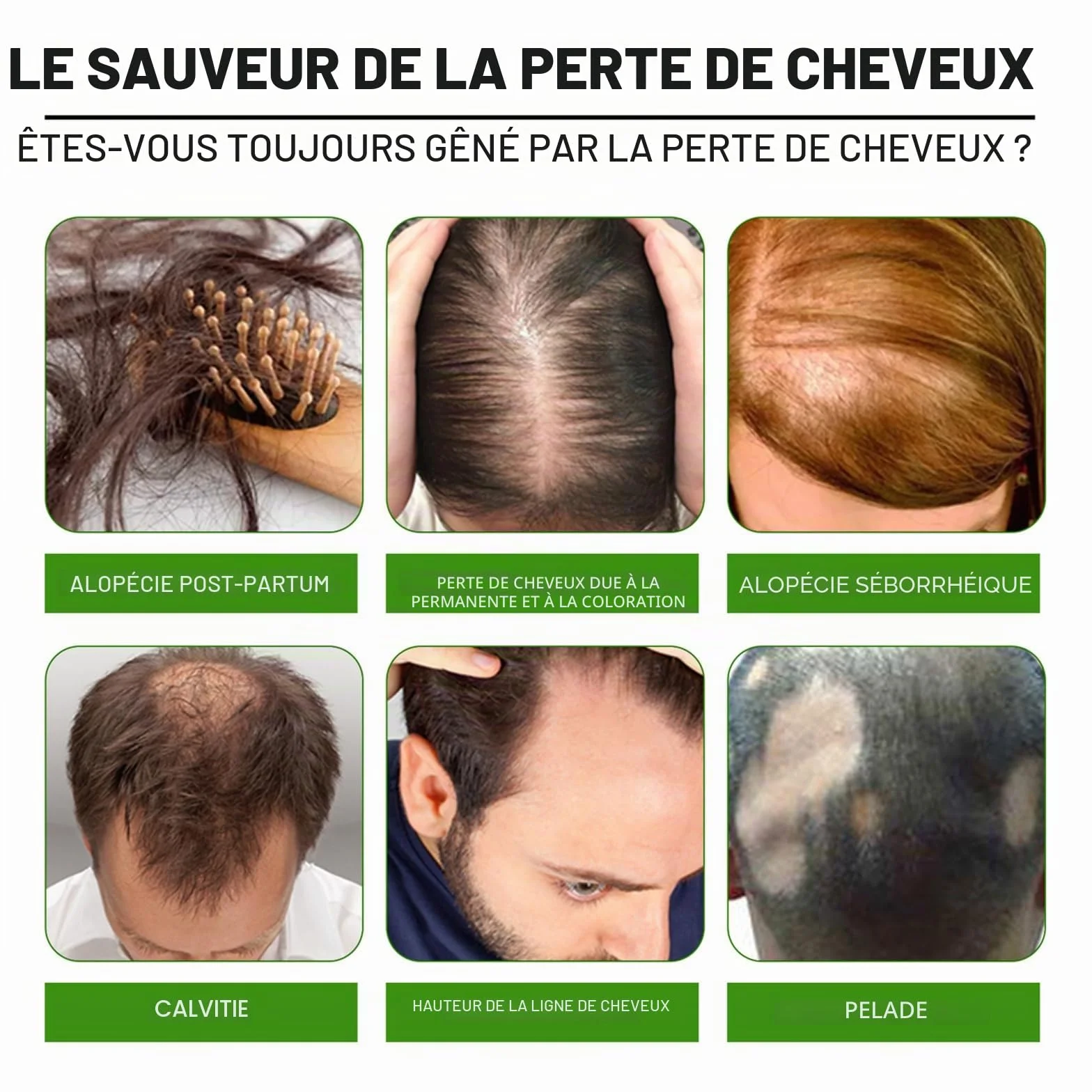 Sérum anti-chute croissance cheveux lot de 2 sprays traitement