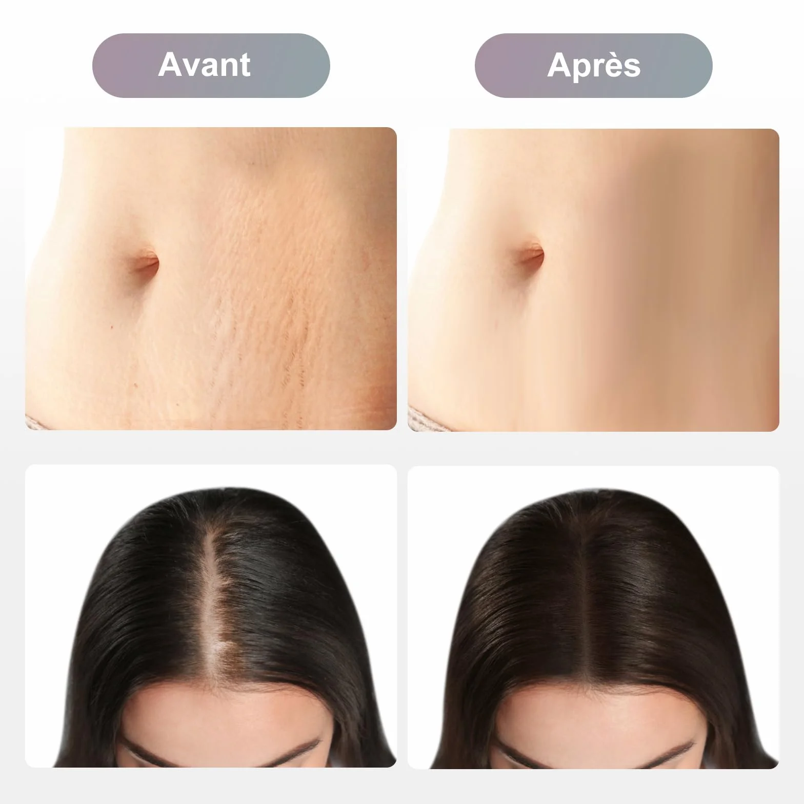 Dr. pen Ultima A10 Lot de 20 cartouches 36 broches pour soin anti-rides, hydratant, raffermissement, éclaircissement, réduction des taches – Cartouches authentiques Dr Pen Ultima A10 20 pièces, 36