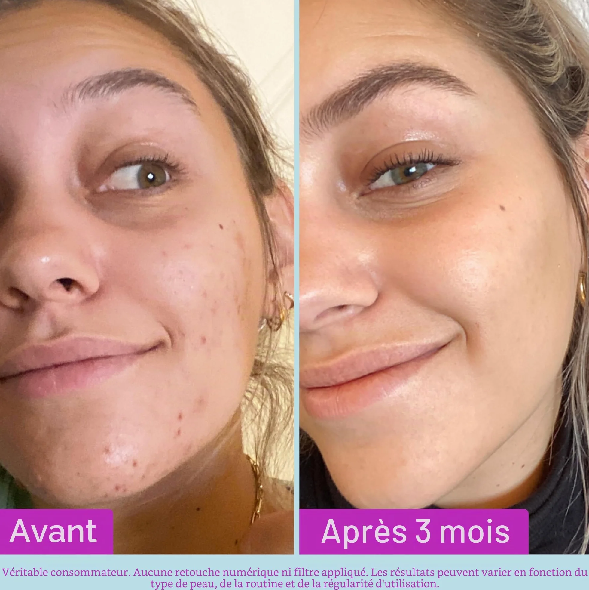 Good Molecules Lotion Tonique Éclaircissante à la Niacinamide - Tonique Facial avec Niacinamide, Vitamine C et Arbutine - Soin du Visage pour le Teint et les Pores Dilatés