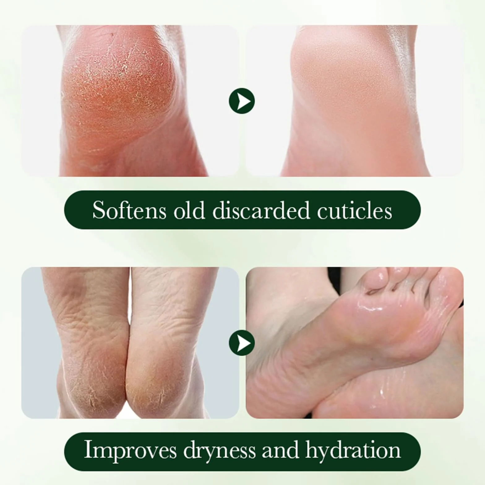 Masques Pieds Avocat Niacinamide Soin Hydratant Intense Pieds Secs Gercés