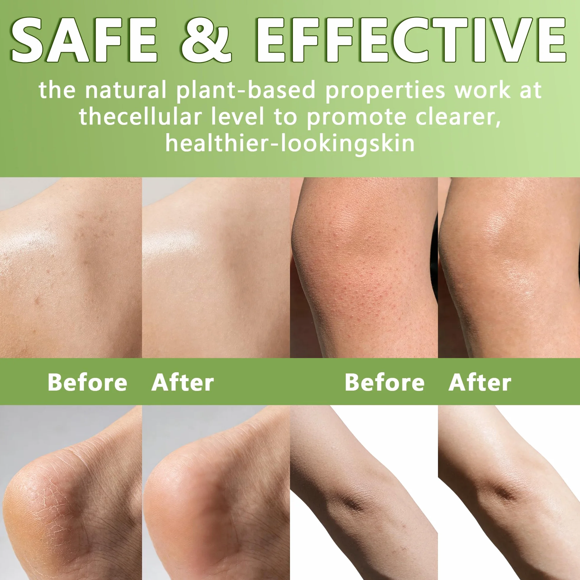 Tea Tree Oil Soap Antifungal Relief Bar Athlete’s Foot Treatment Jock Itch Ringworm Natural Foot Body Soap Gentle Exfoliating 2 Pack