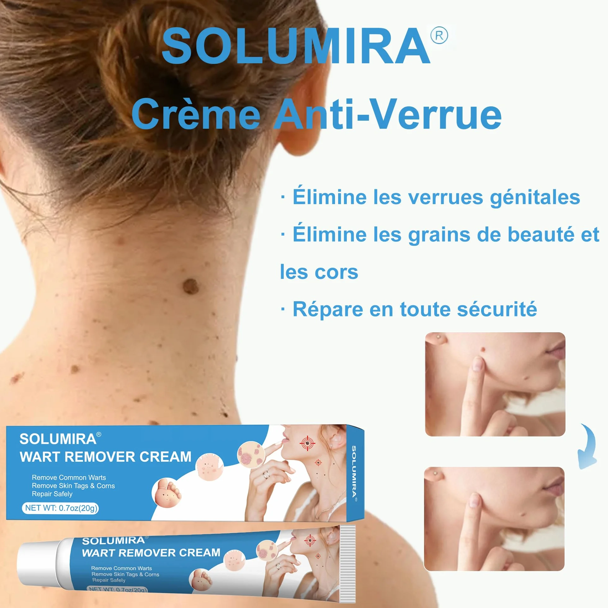 Crème Anti Verrue 20g Élimination Verrues Plantaires Vulgaris Cors Planes