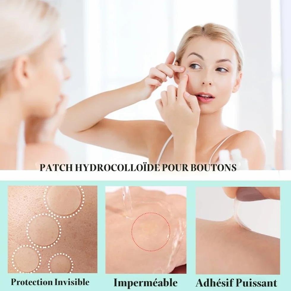 Patch Acne Pimple Anti-Acné Imperméable Autocollants Hydrocolloïde 300PCS