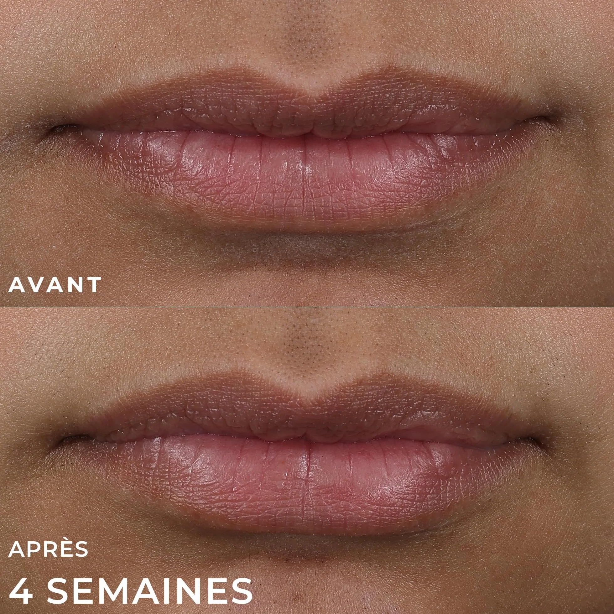 RoC Derm Correxion Lip Volumizer Baume Repulpant Acide Hyaluronique Peptides Collagène 10 ml