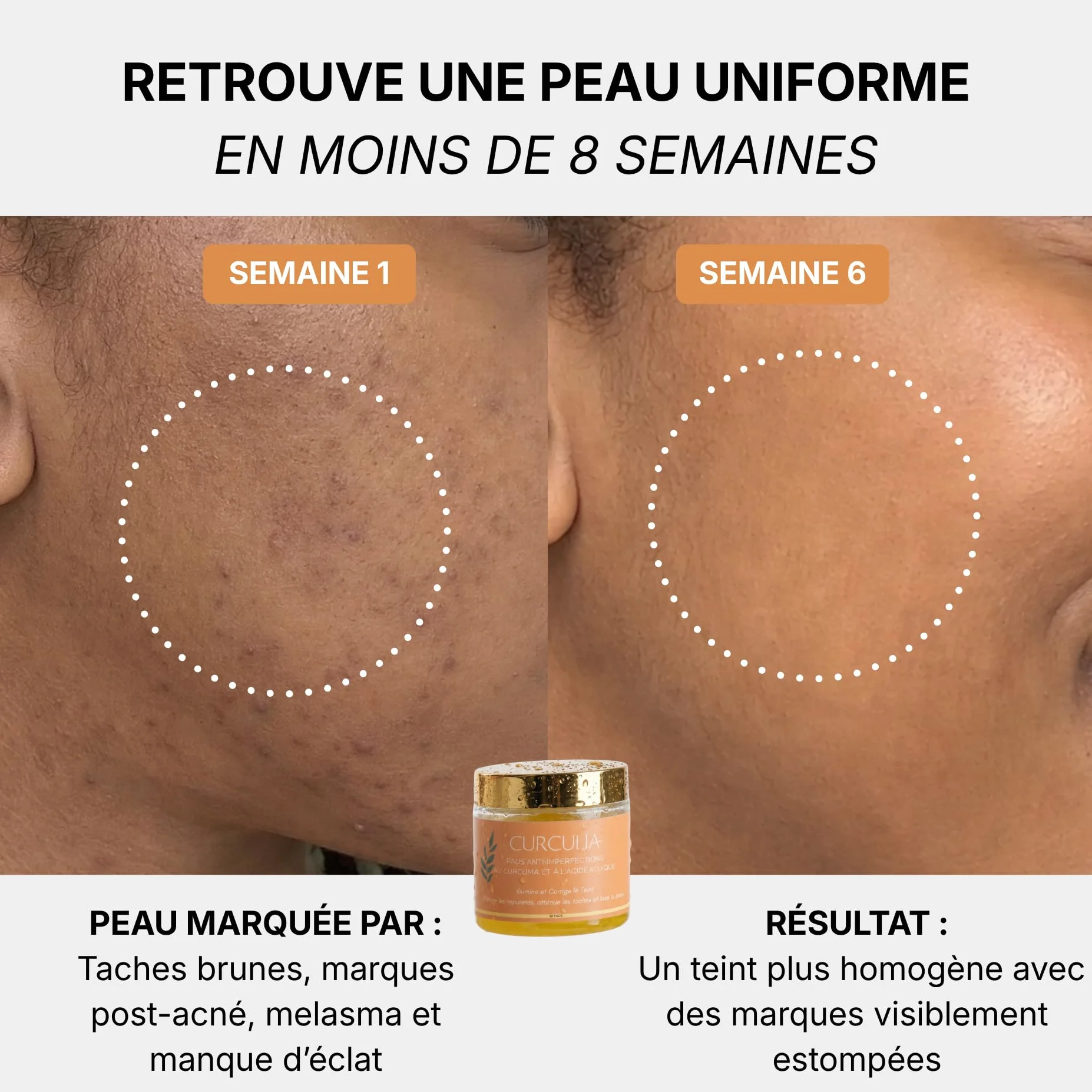 Pads Anti-Imperfections au Curcuma - 250g