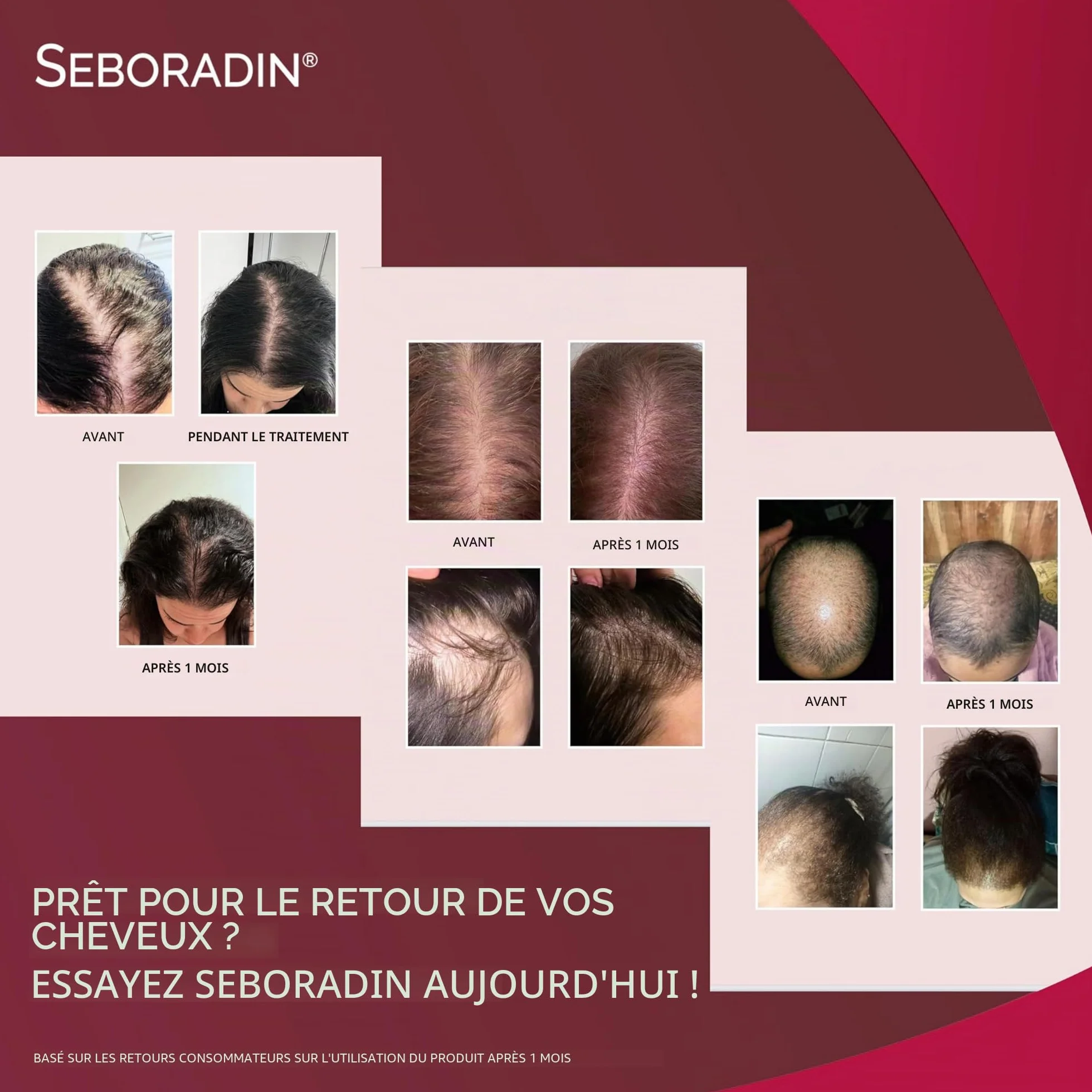 Seboradin Ampoules FORTE Anti-chutes Traitement Intensif Calvitie 14x5,5 ml Hommes