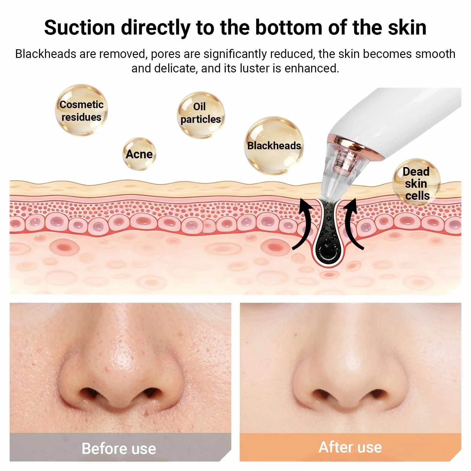 Aspirateur Point Noir 6 Sondes et 3 Modes, Extracteur Point Noir pour l'élimination des Blackheads, Boutons, Graisse