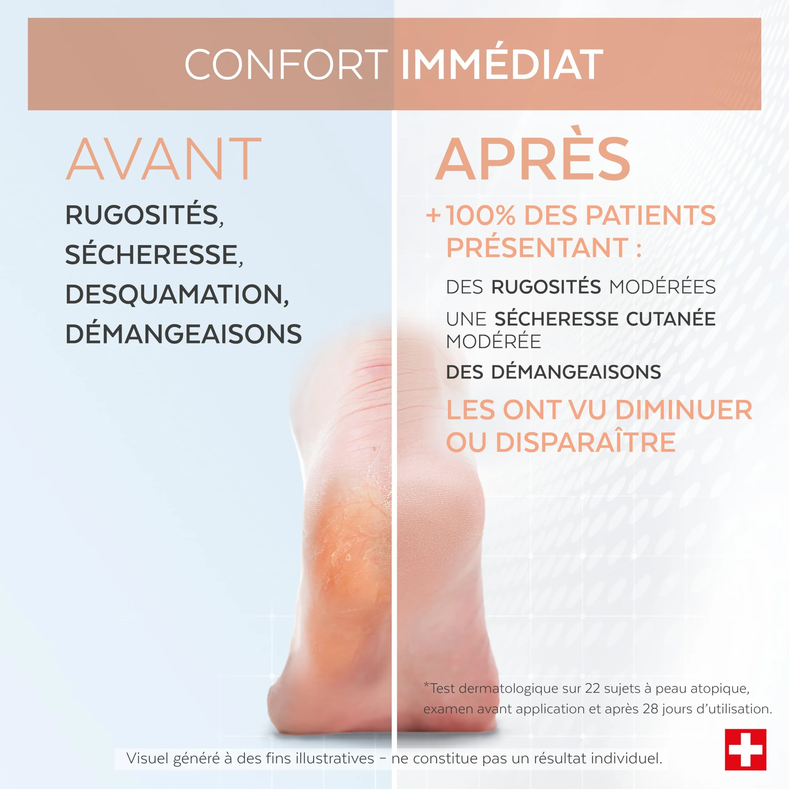 PODERM Sérum Mycose Pieds Athlète au Tea Tree | Répare et Apaise les Irritations, les Démangeaisons et la Desquamation | Post-Mycose, Psoriasis, Eczéma | Soin des Pieds | Fabriqué en Suisse.