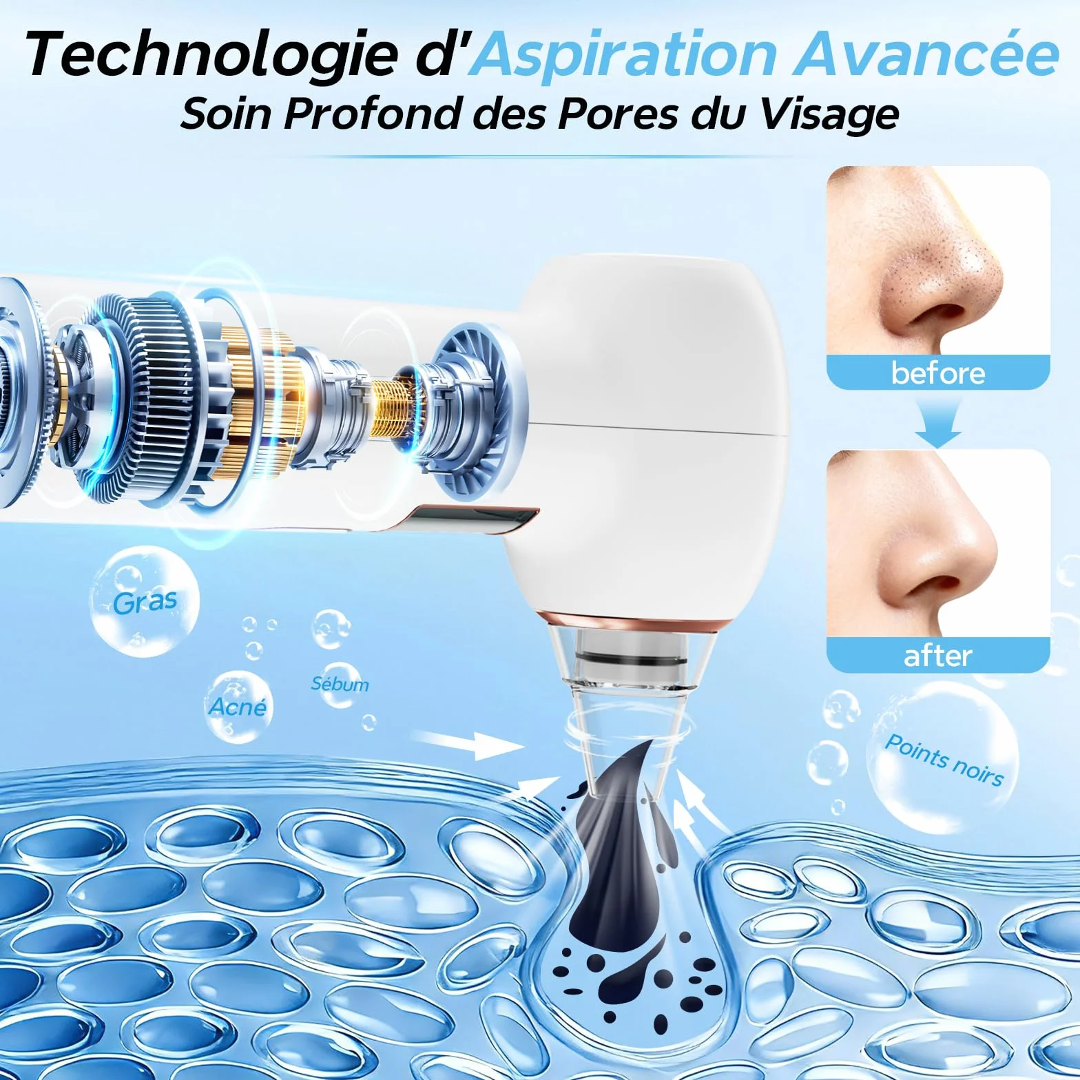 Aspirateur Point Noir 3 Modes Visage 5 Sondes, Blanc | Extracteur de Point Noir, Nettoyage du Visage, Inclut Ensemble Traditionnel d'Aiguilles,tire comedon