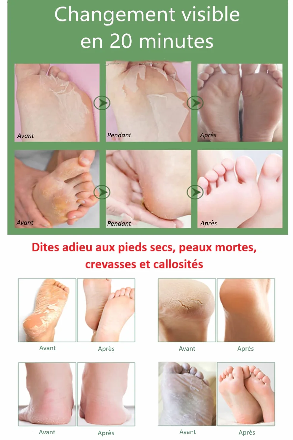 Masques Mains & Pieds Bio Naturel Noix de Coco Hydratant Réparateur Peau Sèche