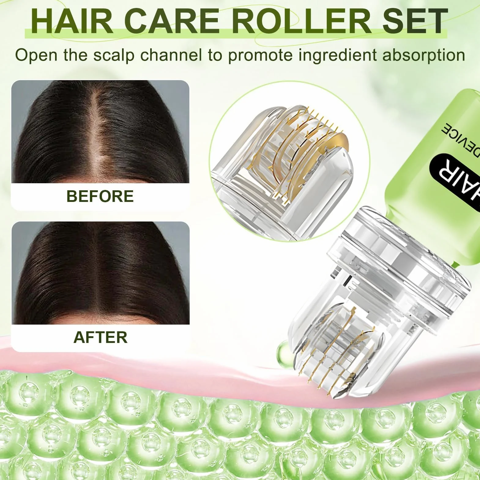 Alphainfuse Système de Repousse Capillaire Kit Microinfusion Technologie Indolore Repousse Rapide Cheveux