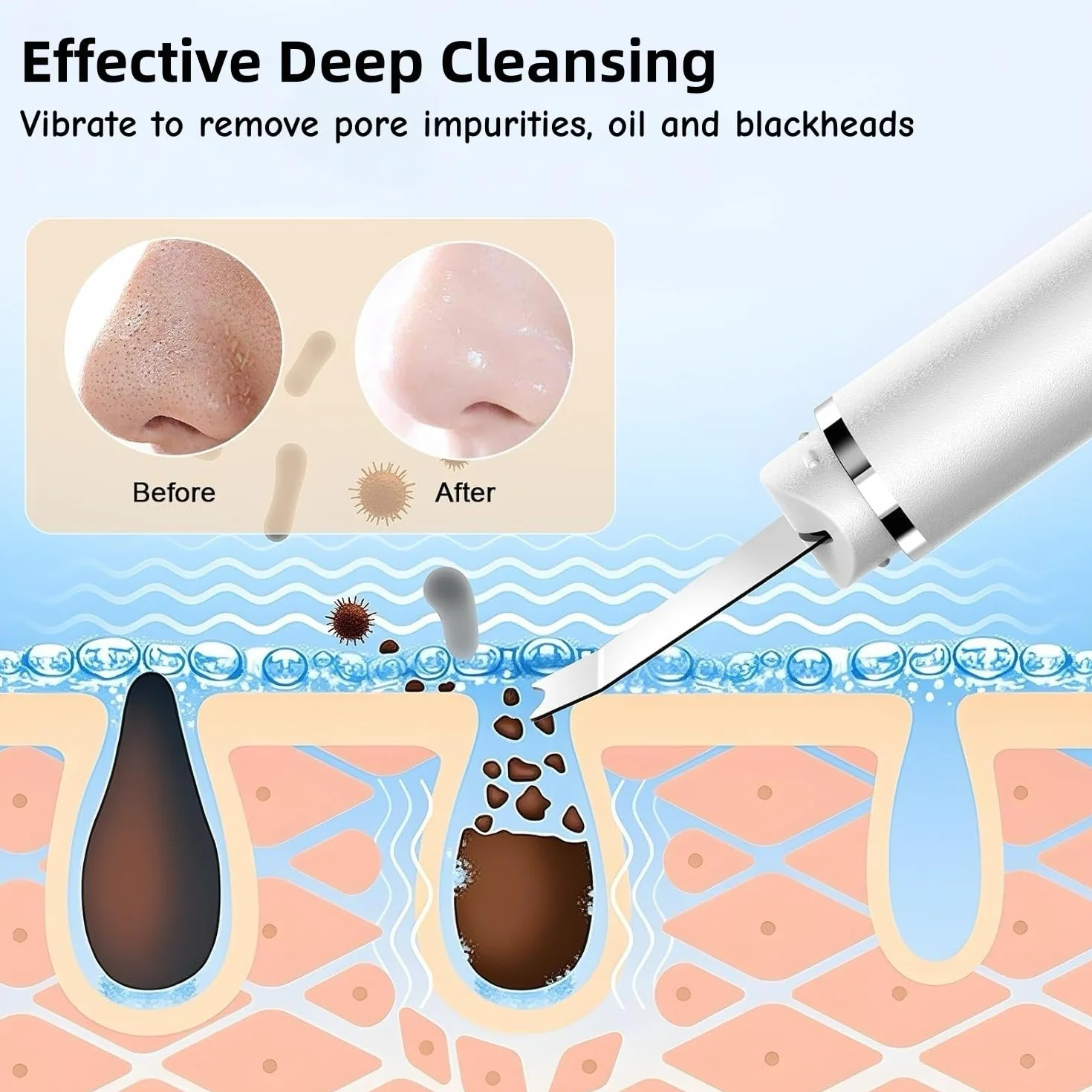 Appareil exfoliant ultrasonique pour la peau, élimine les points noirs, nettoie les pores et les rides, nettoie le visage en profondeur, 4 modes, rechargeable par USB, 2 protections en silicone