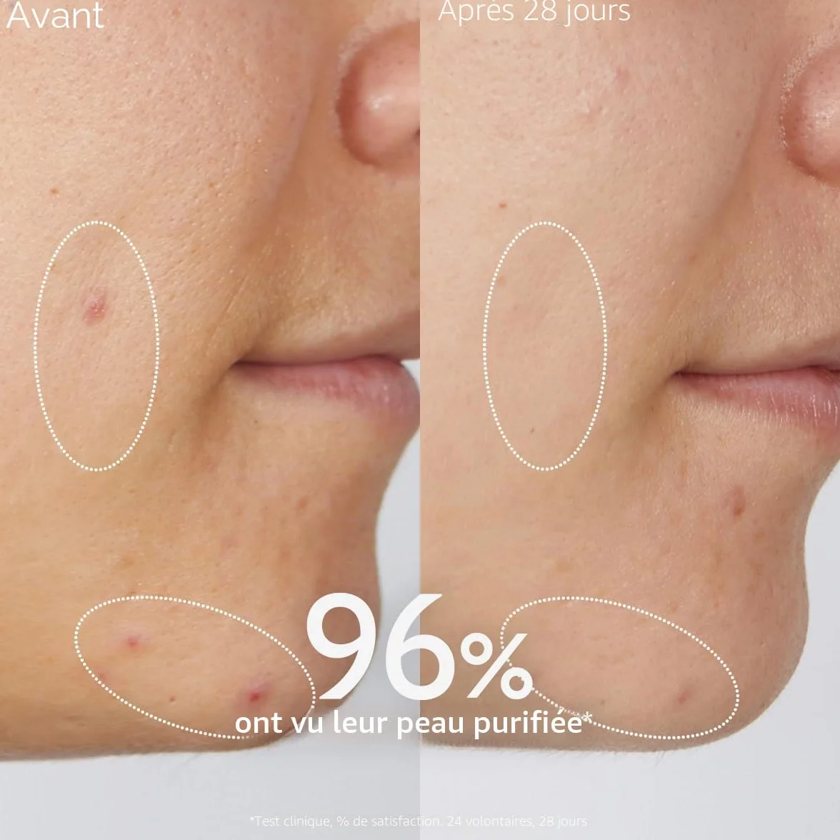 Caudalie Vinopure Gel Nettoyant Clarifiant Acide Salicylique 150 ml