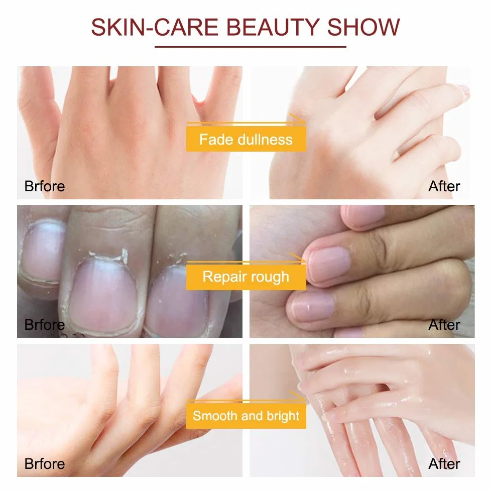 Masques hydratants exfoliants mains lait miel - Gants nourrissants peau sèche craquelée