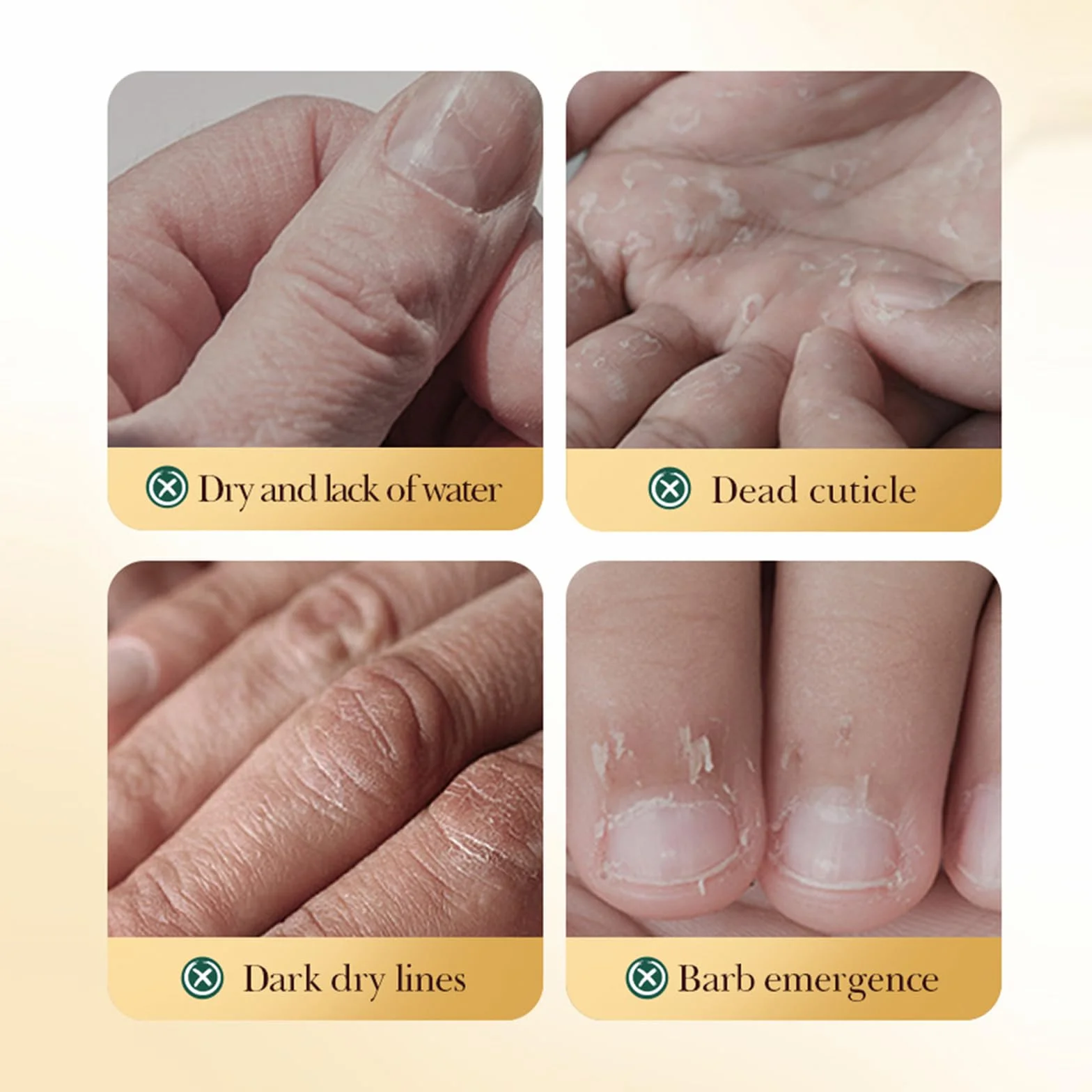 Masque Exfoliant Au Miel Pour Mains, 5 Pièces Gants Nourrissants Peau Sèche