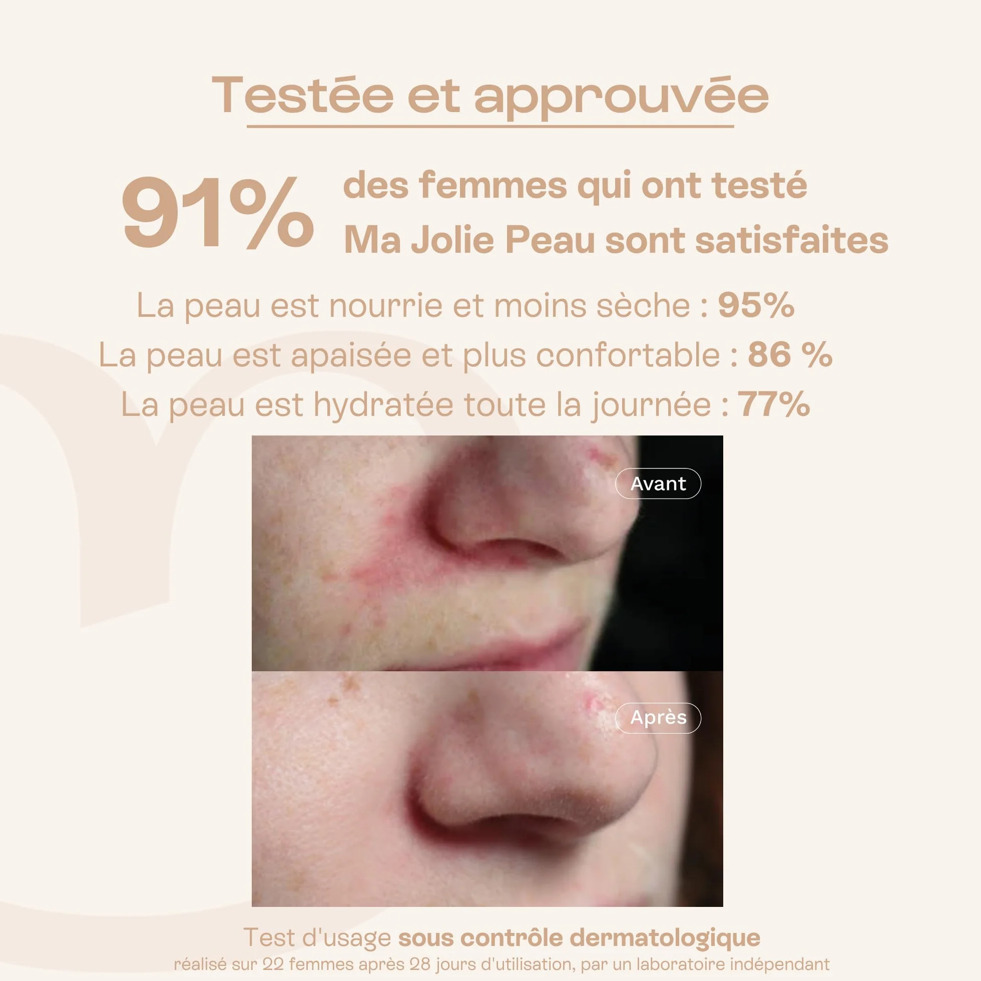 OMUM - Ma Jolie Peau - Crème visage rééquilibrante & hydratante aux prébiotiques naturels - Peaux mixtes et peaux fragilisées - Anti rougeur et anti bouton - Compatible grossesse - Vegan - 40 ml