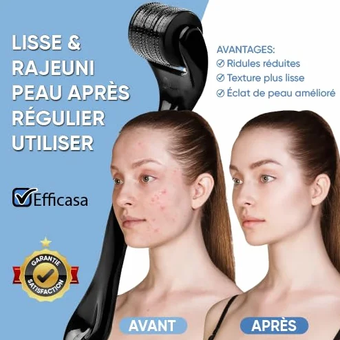 Dermaroller Microneedling 540 Micro-Aiguilles Titane Médical 0,5 mm Visage Repousse Cheveux Barbe Réduction Cicatrices Rides