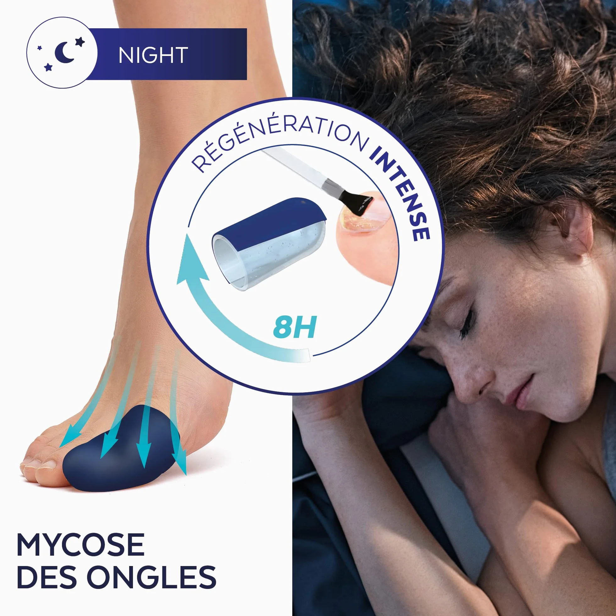 PODERM – MYCOSE ONGLE TRAITEMENT INTENSIF NUIT 2en1 – Élimine la mycose & renouvelle l’ongle pendant votre sommeil |VEGAN | Soin professionnel pied/main | Facile & rapide | Swiss Made