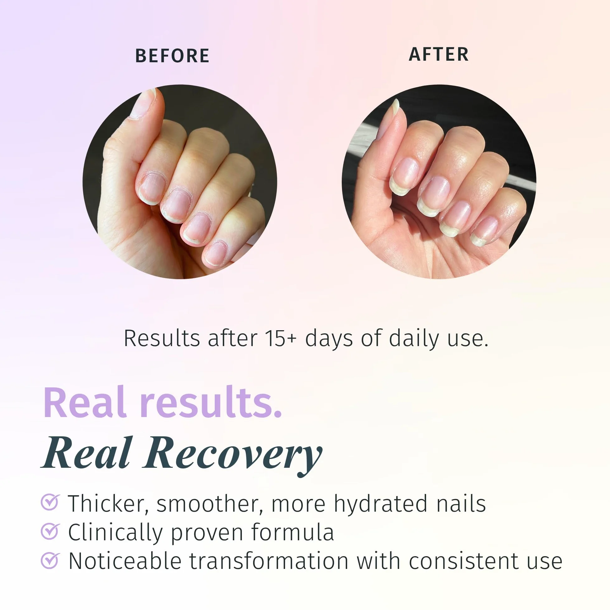 Duri Rejuvacote 2 Nail Growth System Base and Top Coat, 13.3 ml.