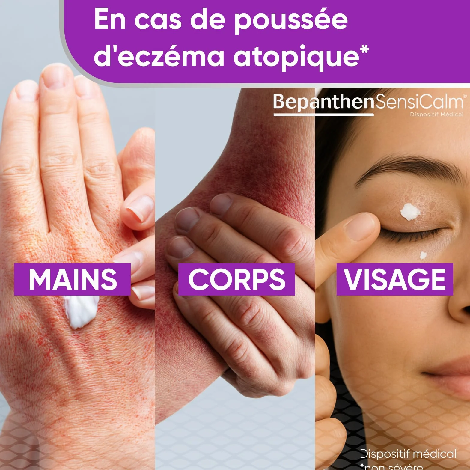 Bepanthen Sensicalm Crème Eczéma Anti Démangeaisons 50g + Baume Relipidant 10ml