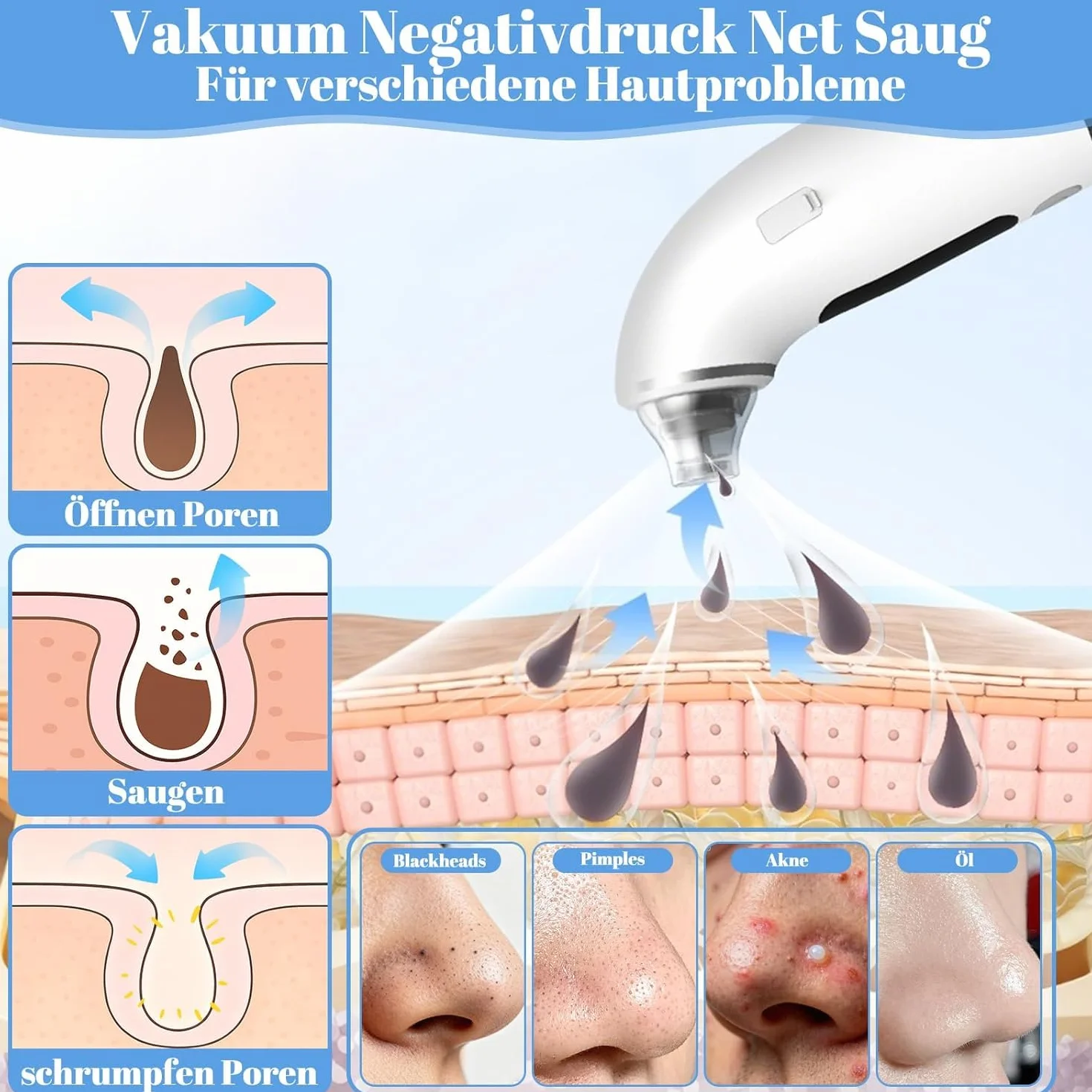 Aspirateur Points Noirs, Extracteur Points Noirs Visage, 4 Modes, 6 Sondes, 75 kPa Super puissance, Tire Comedon Points Noirs Anti Point Noir Nez Nettoyage des Pore Peau Soin Visage Blackhead Removal