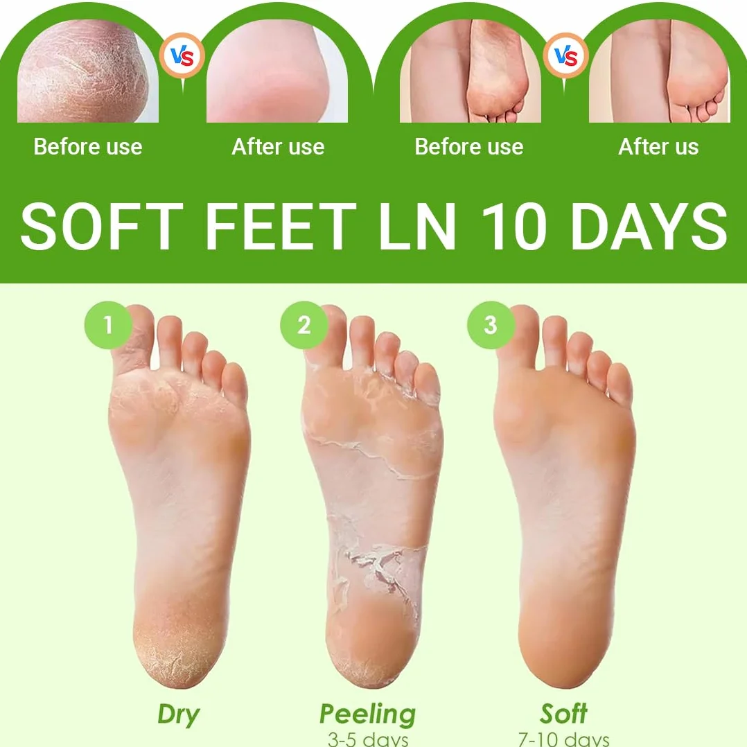 Masque Pieds Peeling Exfoliant Aloe Vera pour Pieds Doux 2 Pièces